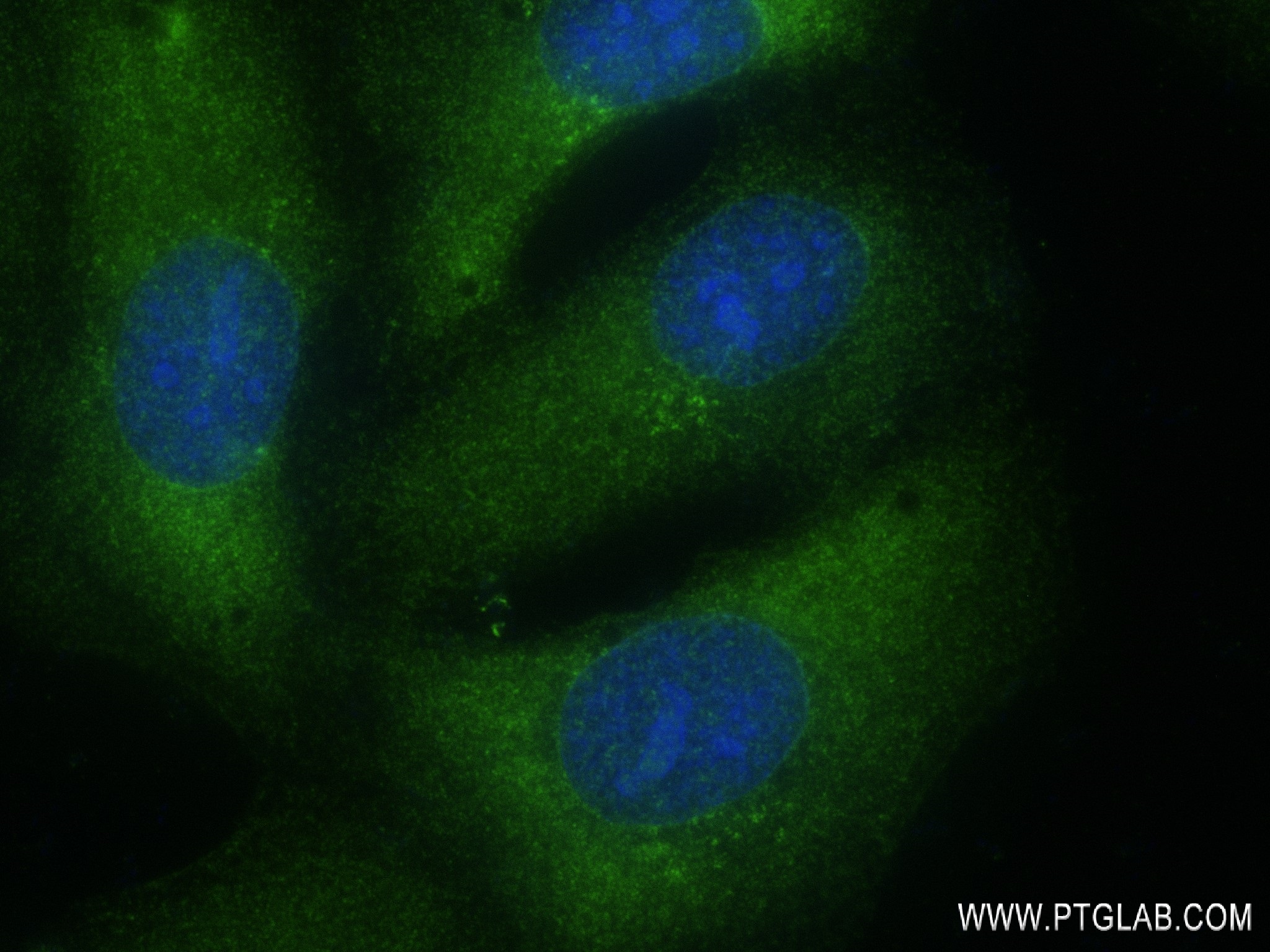 Immunofluorescence (IF) / fluorescent staining of U2OS cells using NEDD4 Recombinant antibody (83112-4-RR)