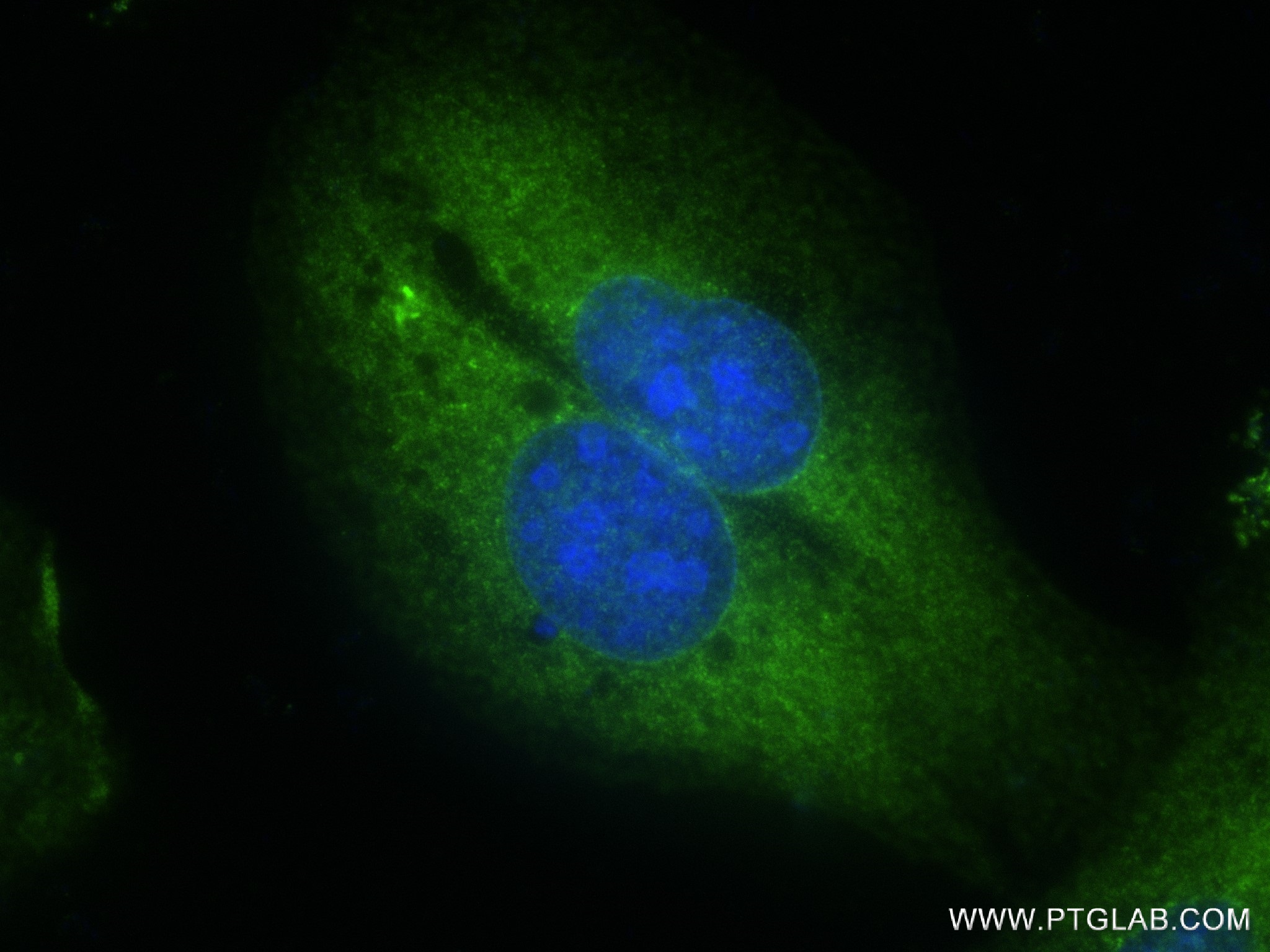 Immunofluorescence (IF) / fluorescent staining of U2OS cells using NEDD4 Recombinant antibody (83112-4-RR)