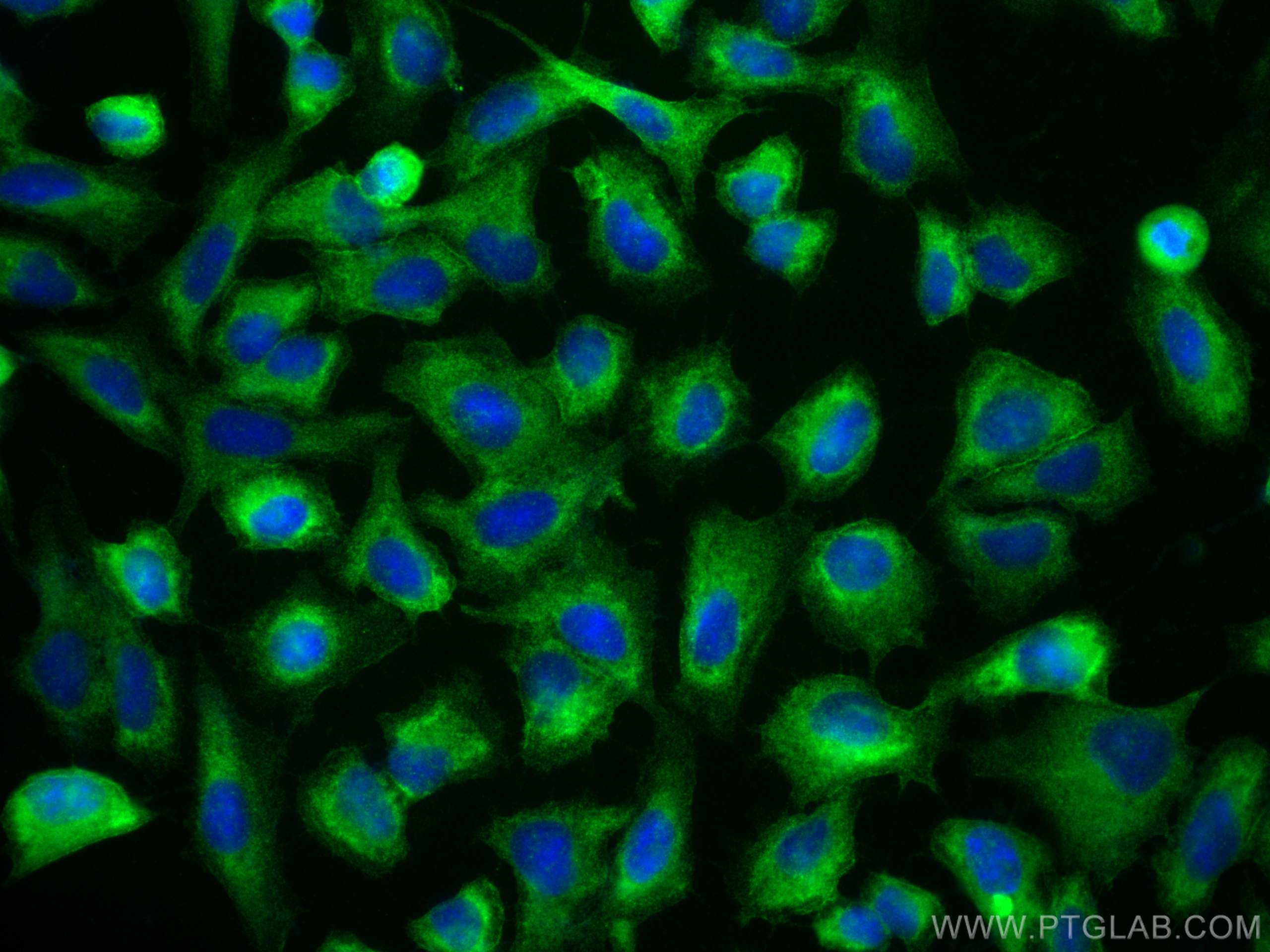 Immunofluorescence (IF) / fluorescent staining of U2OS cells using NEDD4 Recombinant antibody (83112-4-RR)