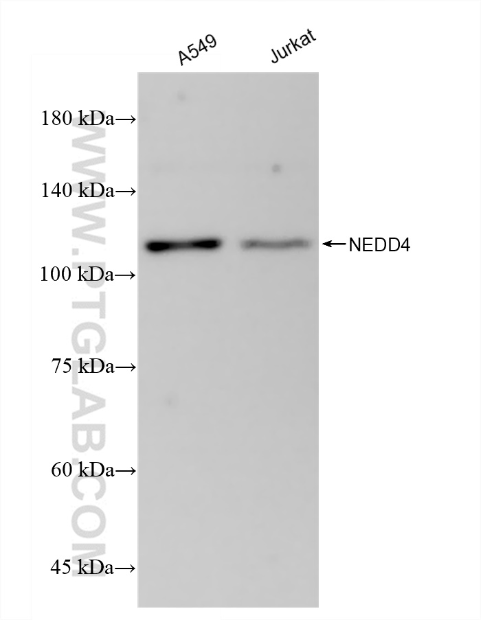 Western Blot (WB) analysis of various lysates using NEDD4 Recombinant antibody (83112-4-RR)