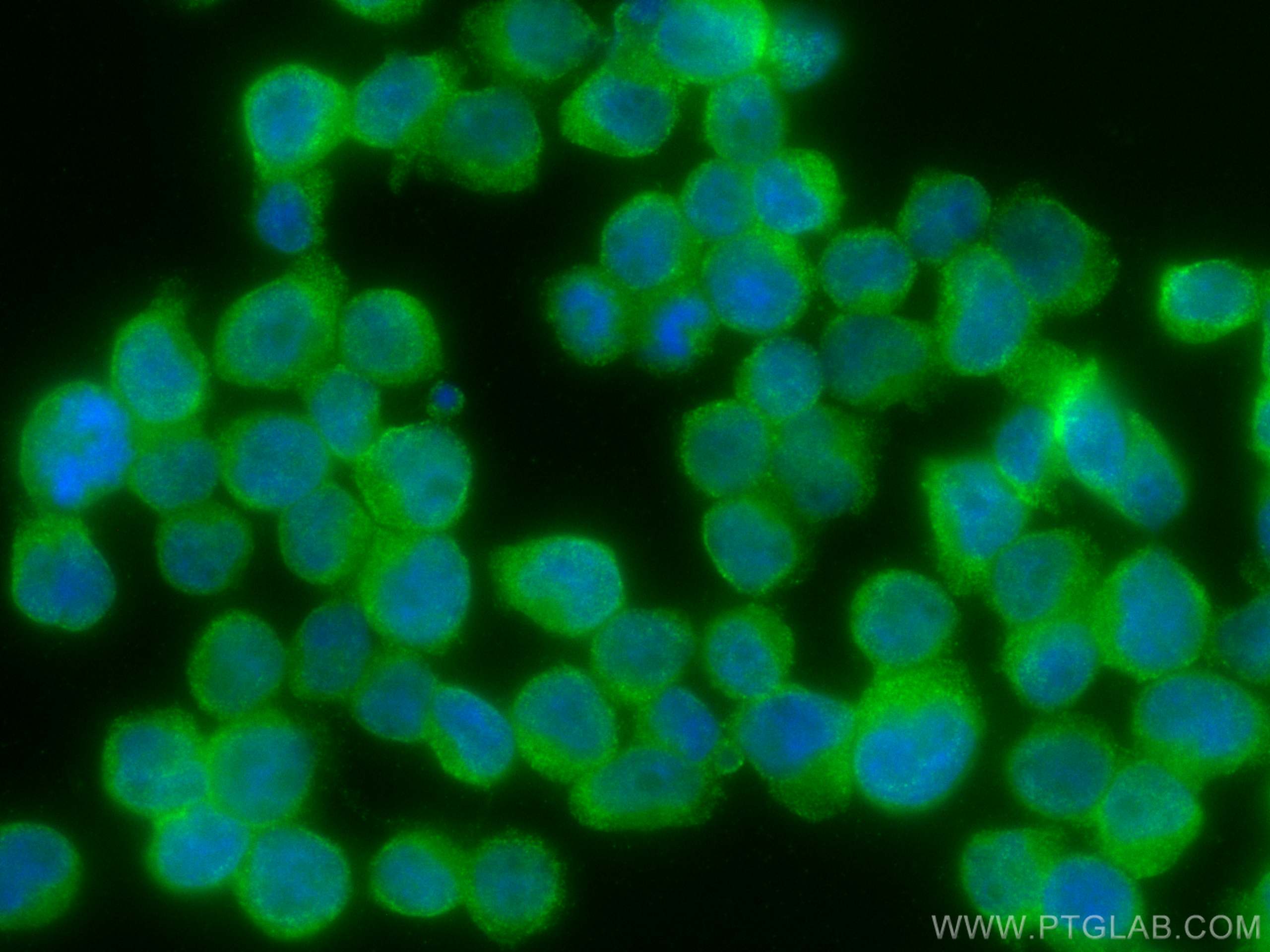 Immunofluorescence (IF) / fluorescent staining of Jurkat cells using NEDD4L Monoclonal antibody (67276-1-Ig)