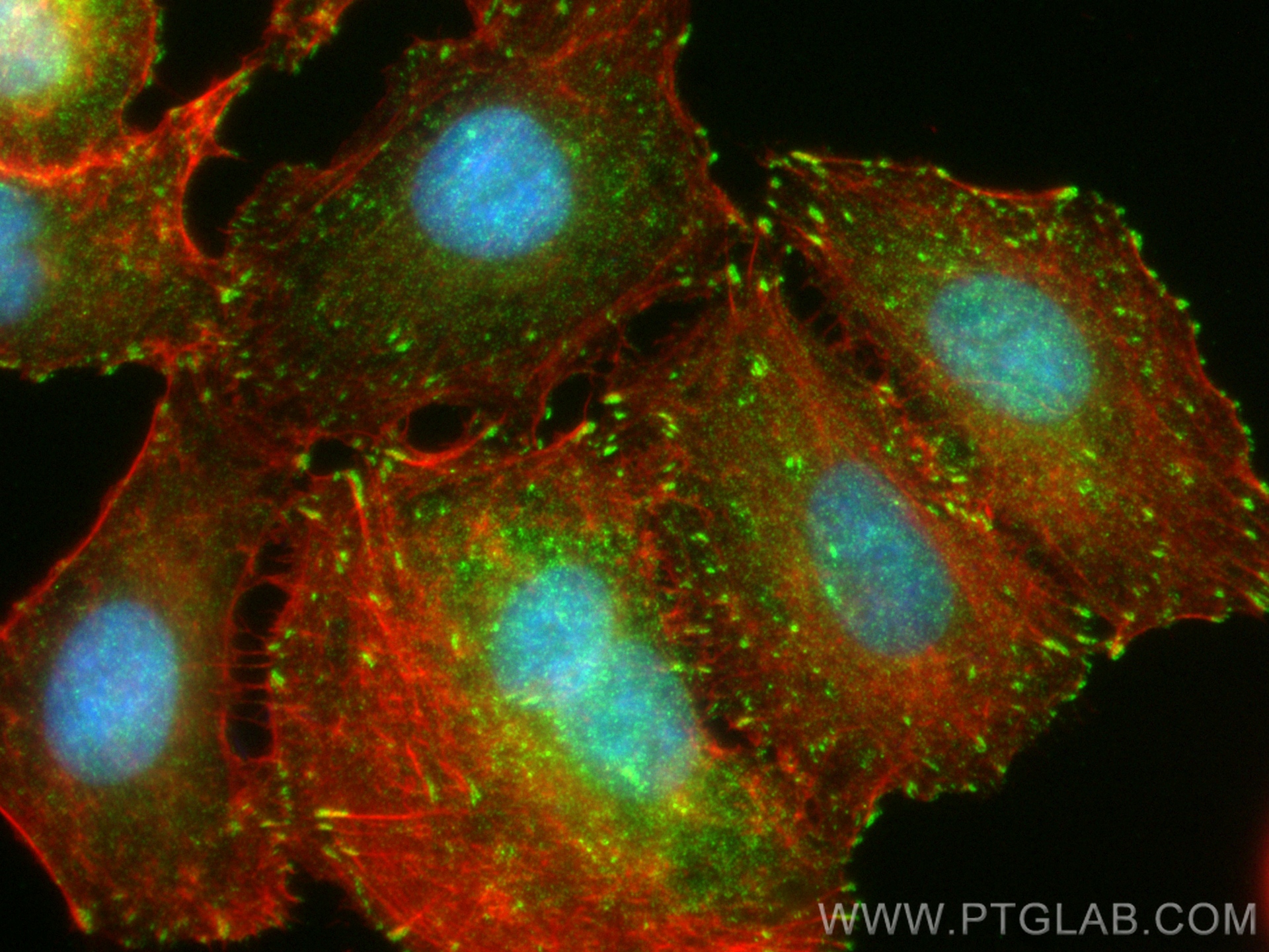 Immunofluorescence (IF) / fluorescent staining of A549 cells using NEDD9 Recombinant antibody (83362-2-RR)