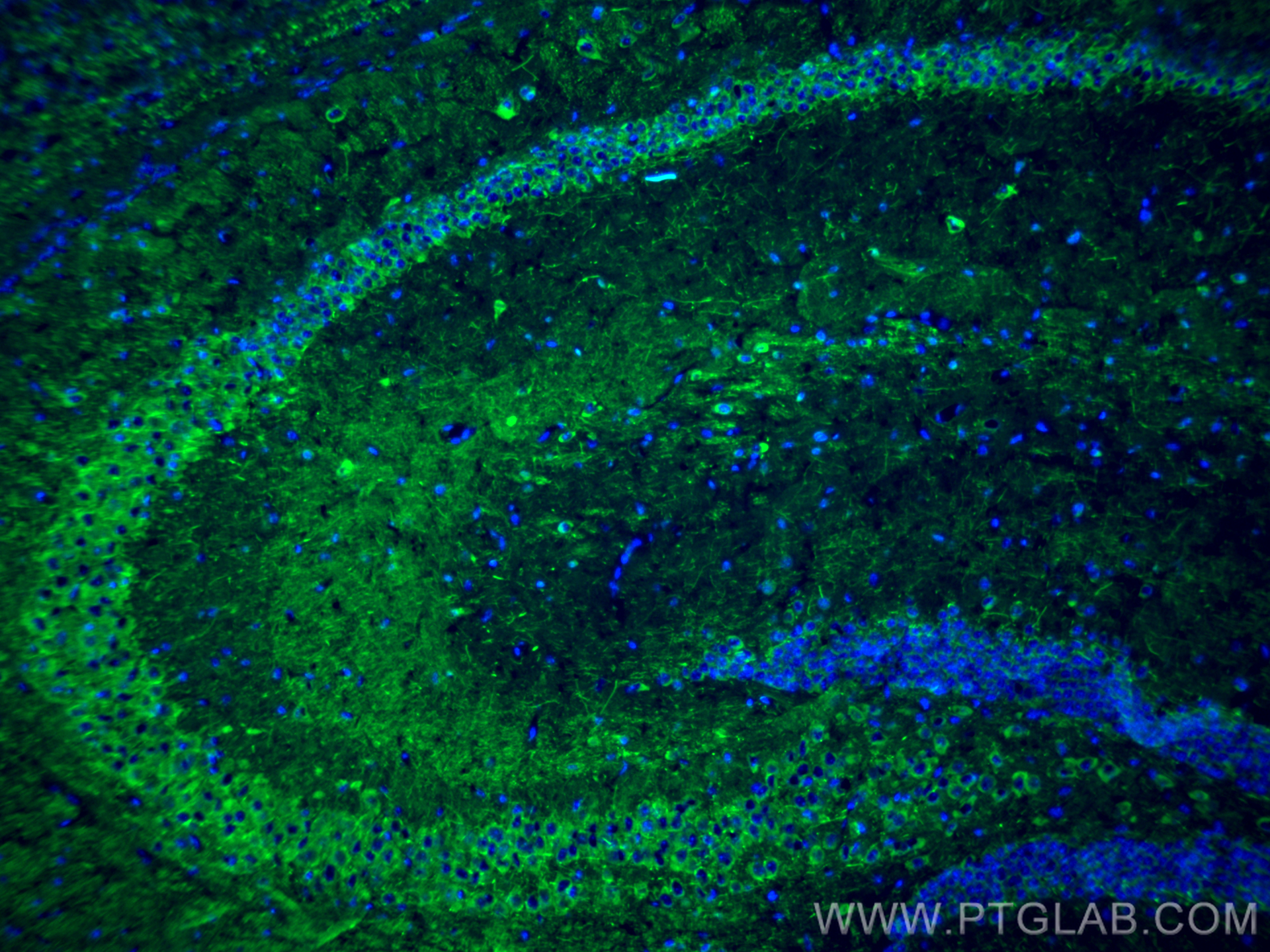 Immunofluorescence (IF) / fluorescent staining of mouse brain tissue using NF-H/NF200 Polyclonal antibody (18934-1-AP)