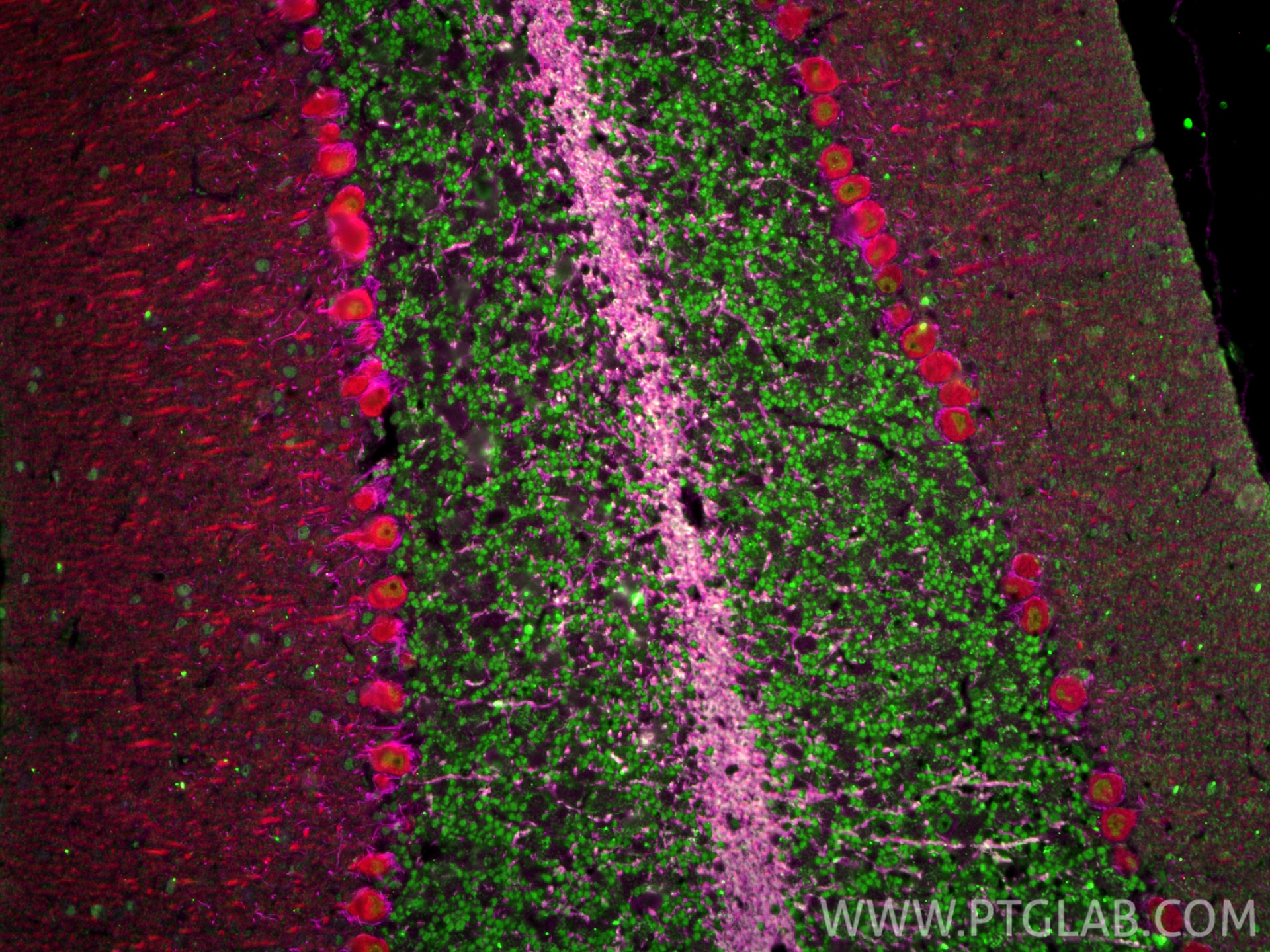 Immunofluorescence (IF) / fluorescent staining of mouse cerebellum tissue using NF-H/NF200 Polyclonal antibody (18934-1-AP)