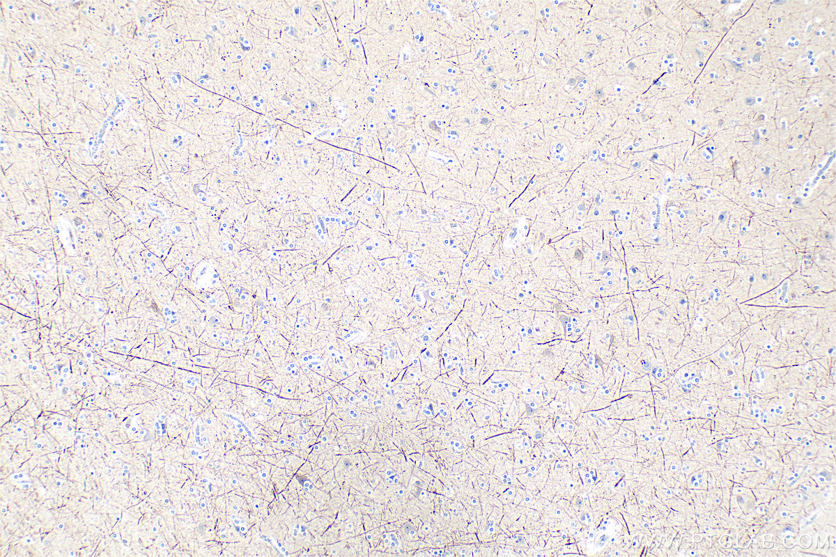Immunohistochemistry (IHC) staining of human brain tissue using NF-H/NF200 Polyclonal antibody (18934-1-AP)