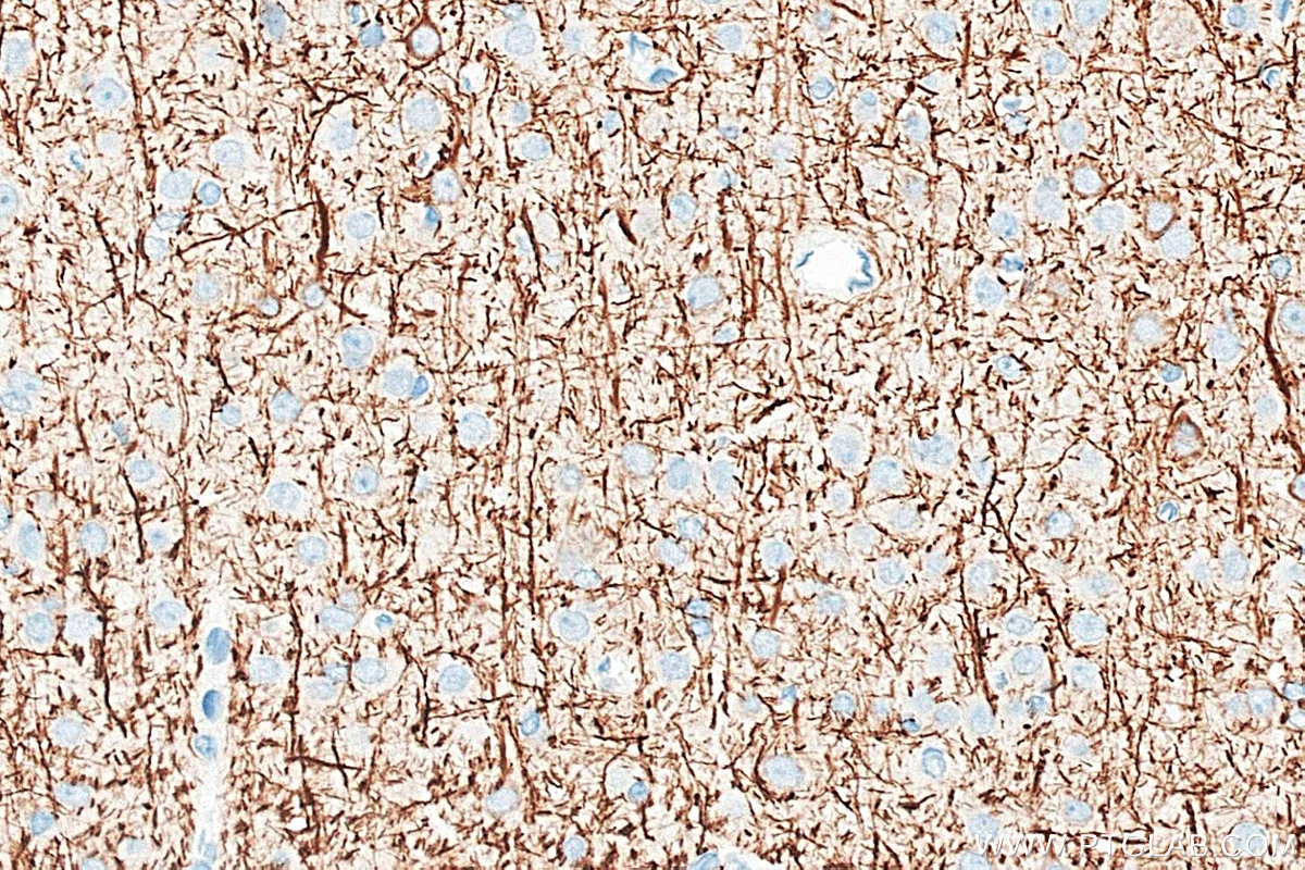 Immunohistochemistry (IHC) staining of rat brain tissue using NF-H/NF200 Polyclonal antibody (18934-1-AP)