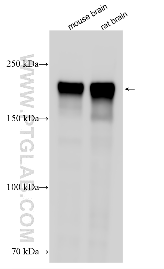 Western Blot (WB) analysis of various lysates using NF-H/NF200 Polyclonal antibody (18934-1-AP)