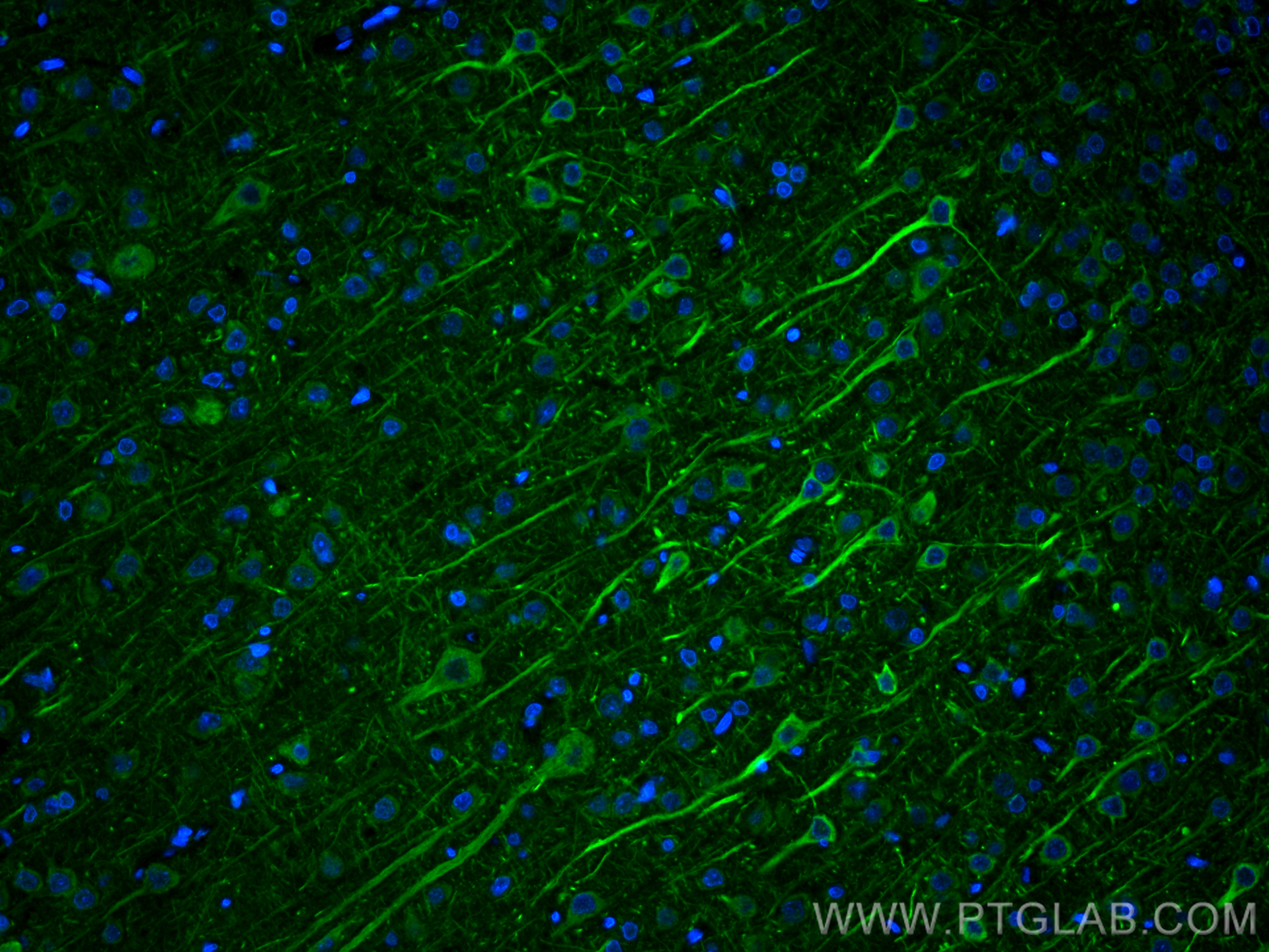 Immunofluorescence (IF) / fluorescent staining of rat brain tissue using NF-H/NF200 Polyclonal antibody (21471-1-AP)