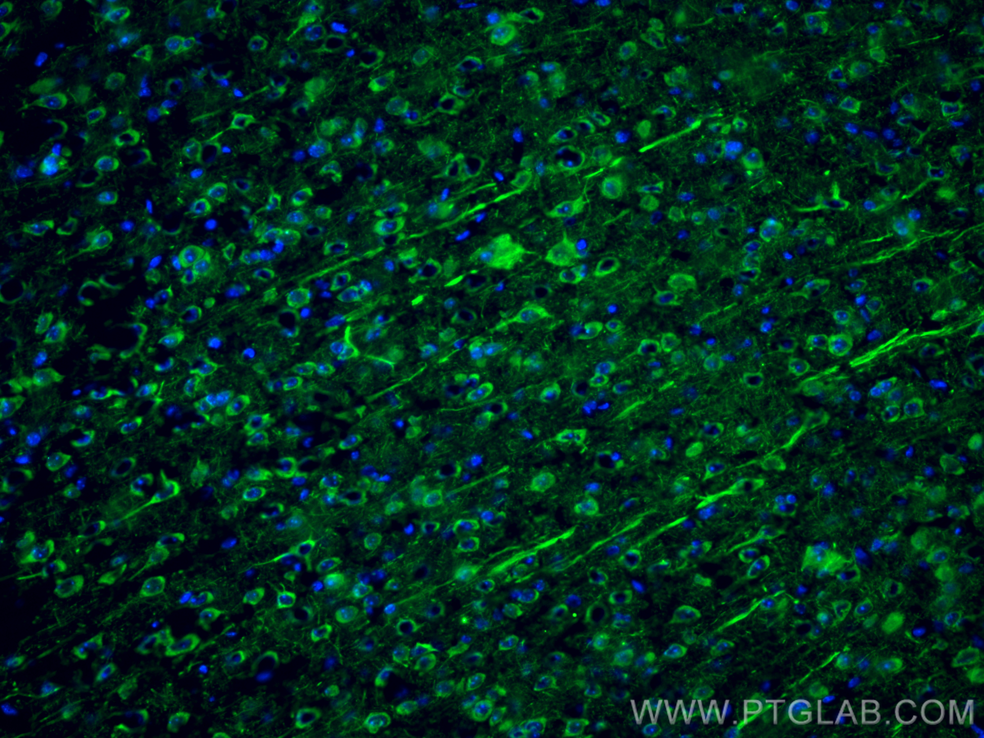 Immunofluorescence (IF) / fluorescent staining of mouse brain tissue using NF-L Monoclonal antibody (60189-1-Ig)