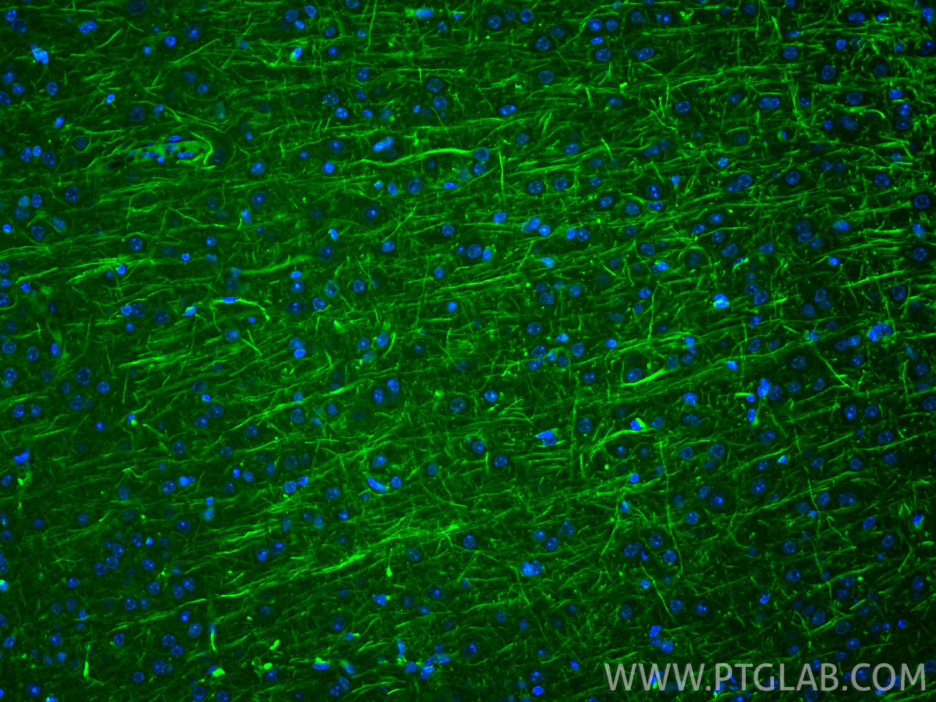 Immunofluorescence (IF) / fluorescent staining of mouse brain tissue using NF-L Monoclonal antibody (60189-1-Ig)