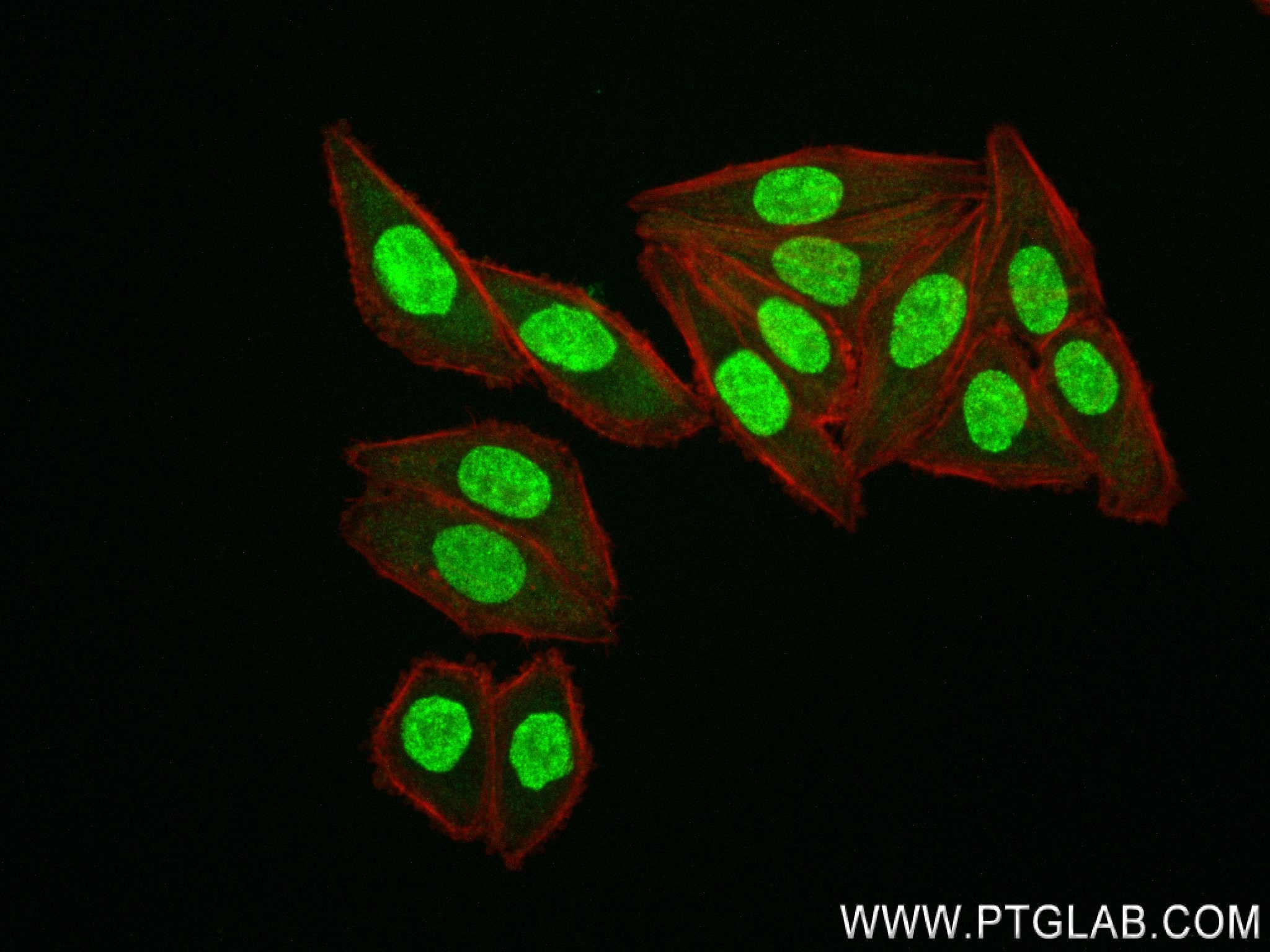 Immunofluorescence (IF) / fluorescent staining of HepG2 cells using NEIL1 Recombinant antibody (83376-3-RR)