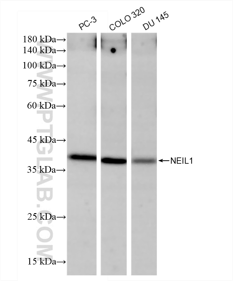 Western Blot (WB) analysis of various lysates using NEIL1 Recombinant antibody (83376-7-RR)