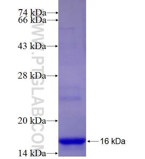 NEIL2 fusion protein Ag25681 SDS-PAGE