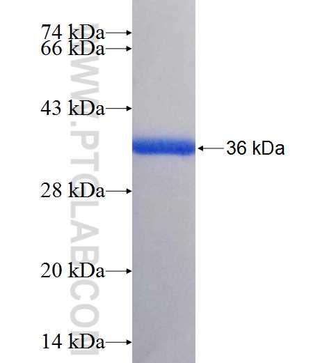 NEK1 fusion protein Ag25988 SDS-PAGE