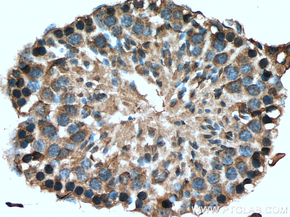 Immunohistochemistry (IHC) staining of mouse testis tissue using NEK2 Polyclonal antibody (14233-1-AP)