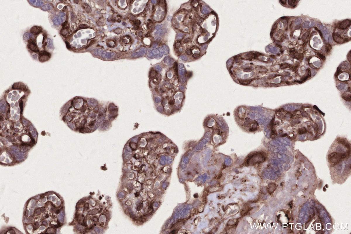 Immunohistochemistry (IHC) staining of human placenta tissue using NEK9 Polyclonal antibody (11192-1-AP)