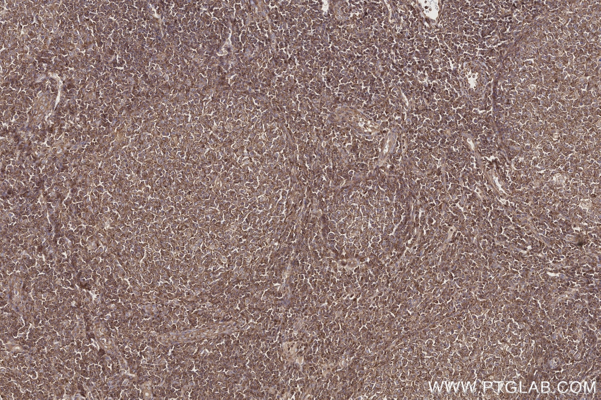 Immunohistochemistry (IHC) staining of human tonsillitis tissue using NEK9 Polyclonal antibody (11192-1-AP)