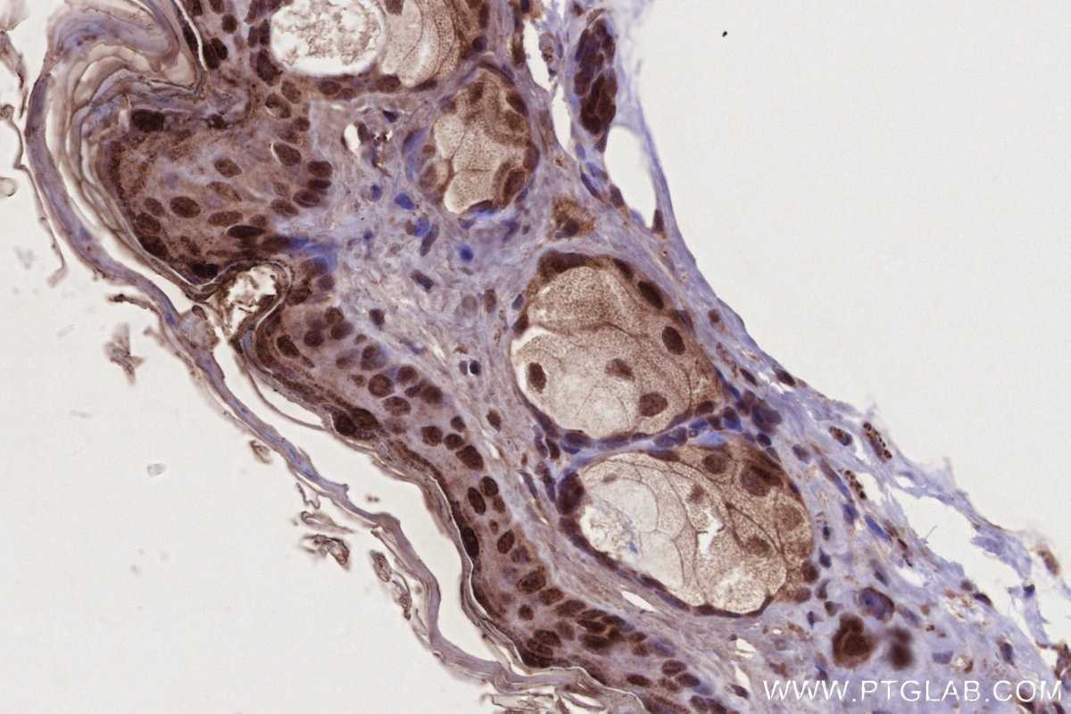 Immunohistochemistry (IHC) staining of mouse skin tissue using NEK9 Polyclonal antibody (11192-1-AP)