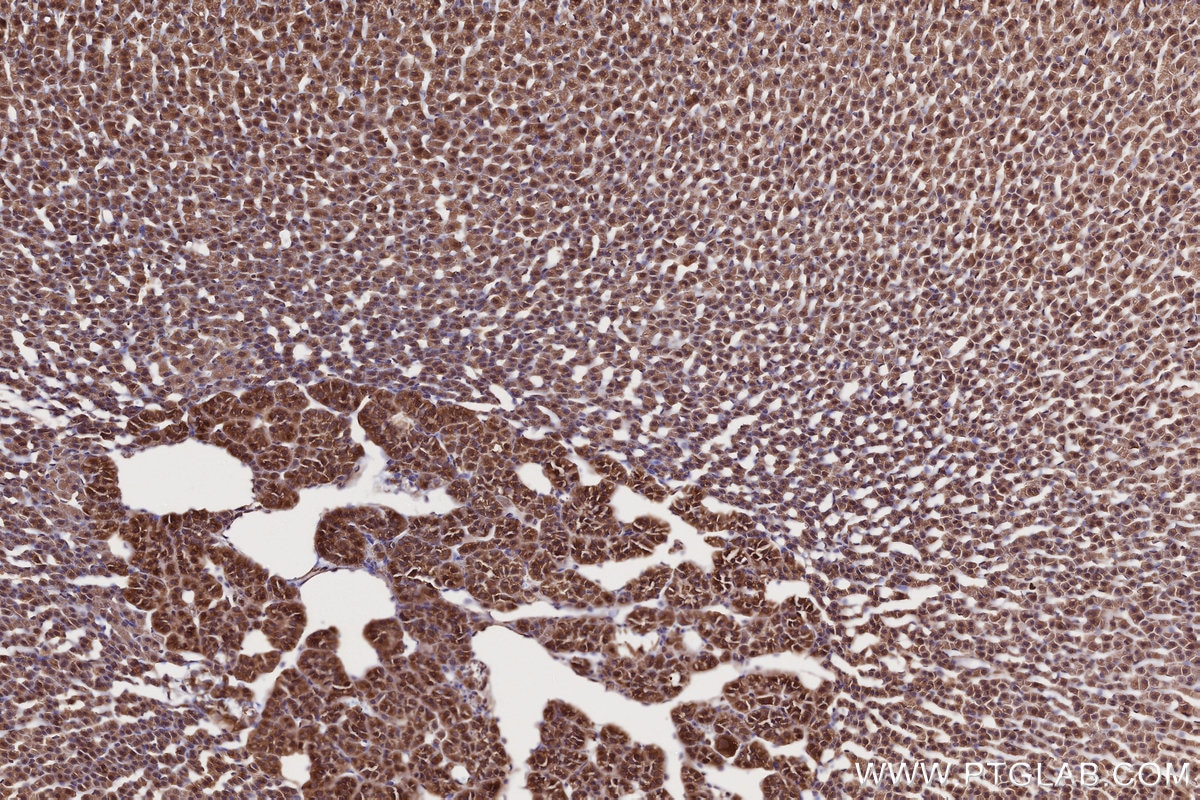 Immunohistochemistry (IHC) staining of rat adrenal gland tissue using NEK9 Polyclonal antibody (11192-1-AP)
