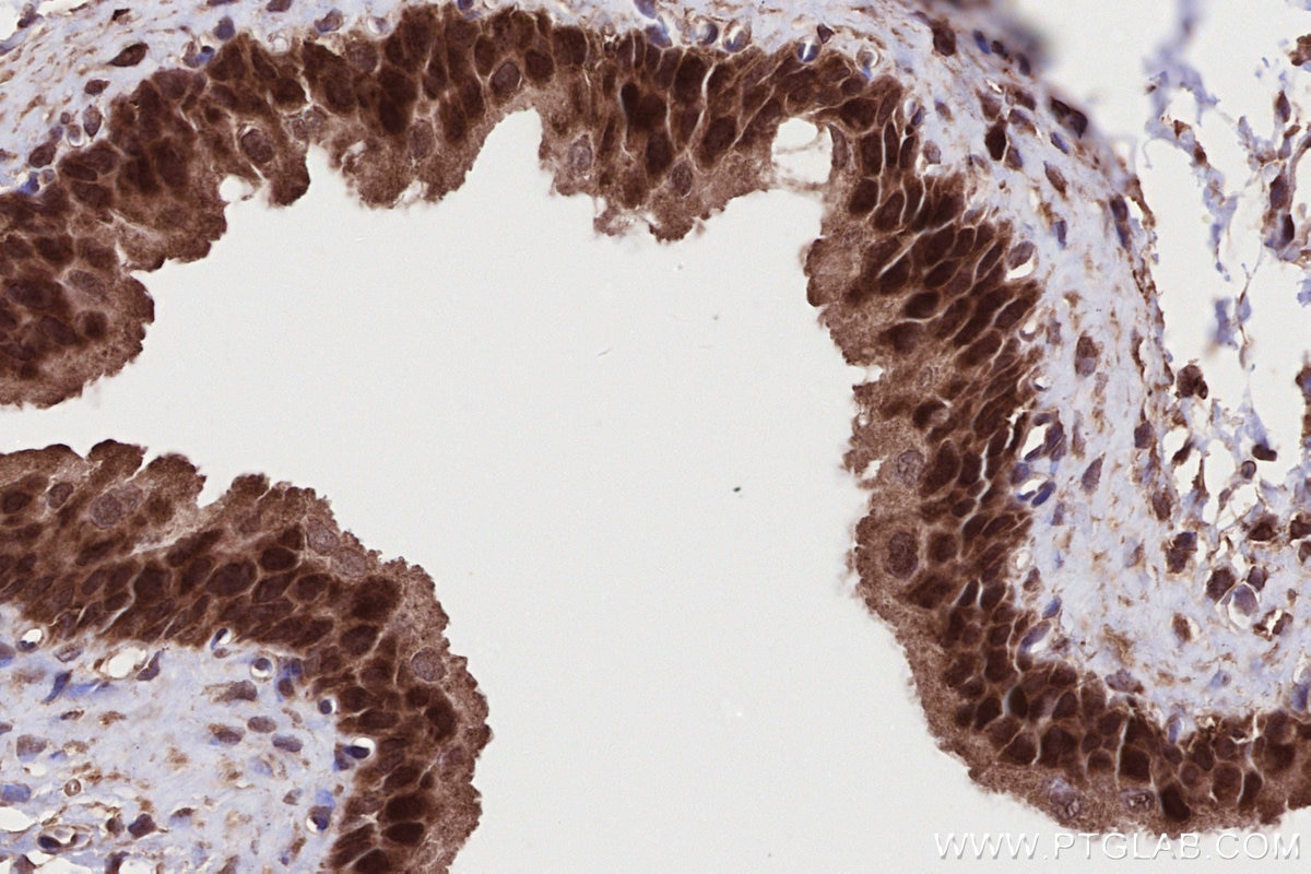 Immunohistochemistry (IHC) staining of rat bladder tissue using NEK9 Polyclonal antibody (11192-1-AP)