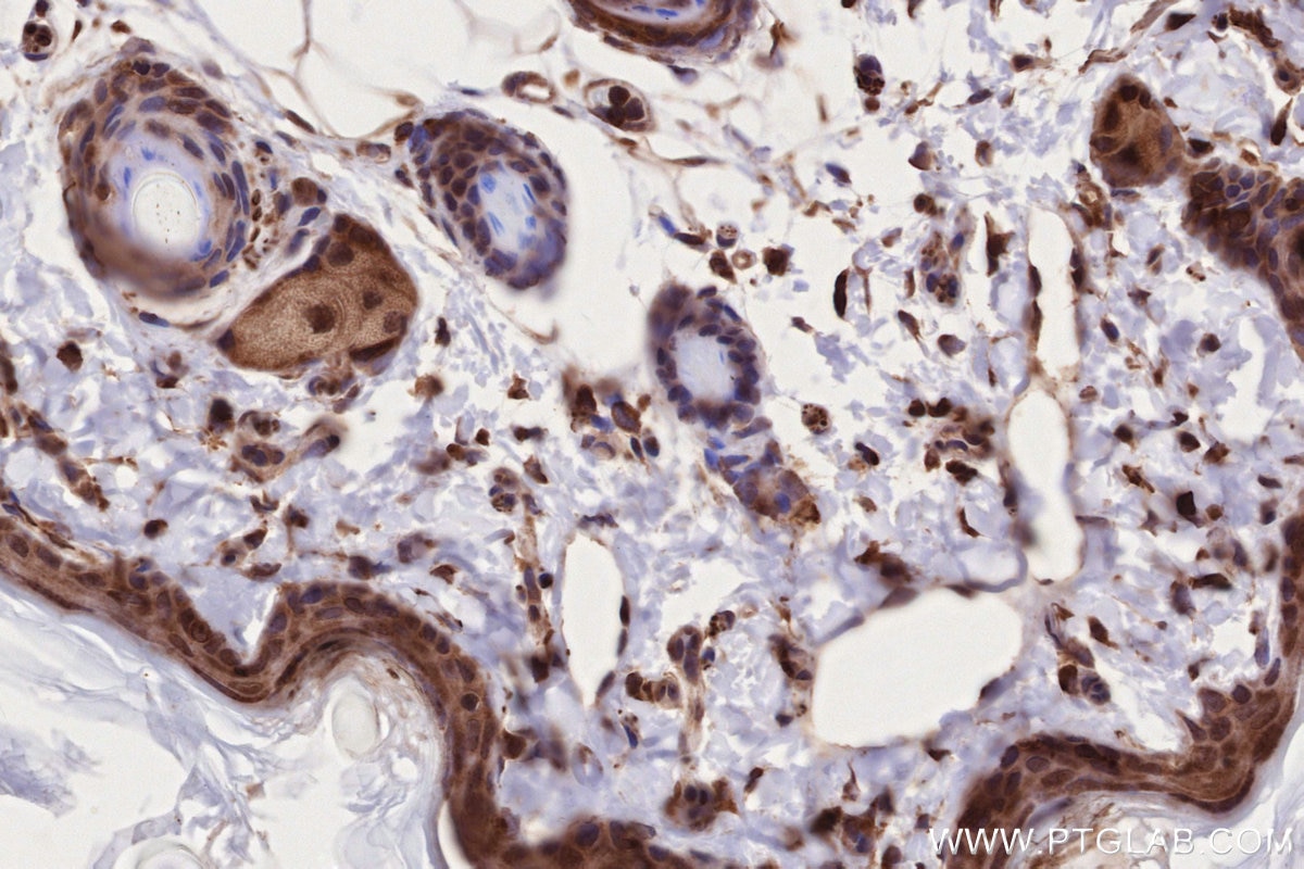 Immunohistochemistry (IHC) staining of rat skin tissue using NEK9 Polyclonal antibody (11192-1-AP)