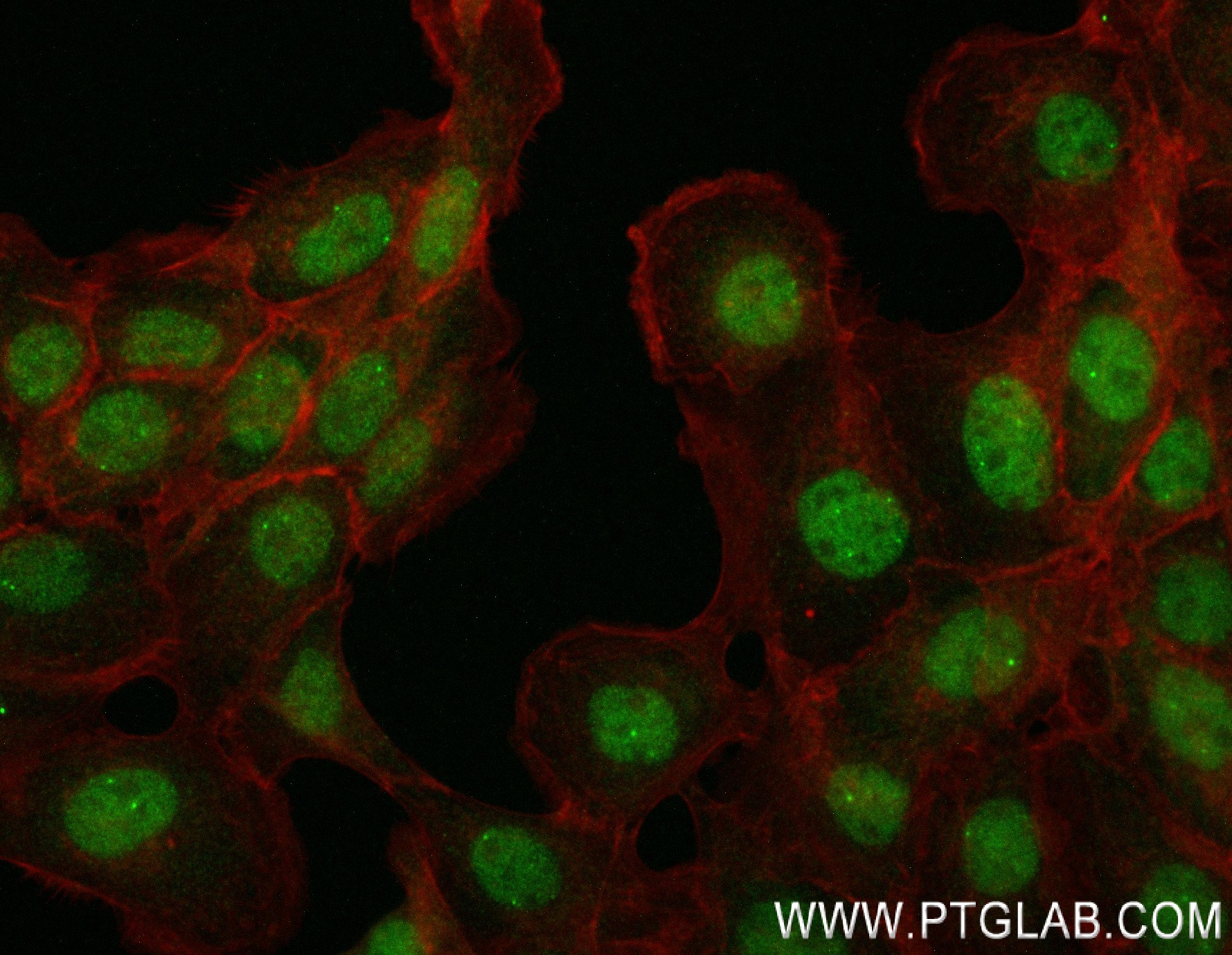 Immunofluorescence (IF) / fluorescent staining of A431 cells using NELFB Recombinant antibody (84135-4-RR)