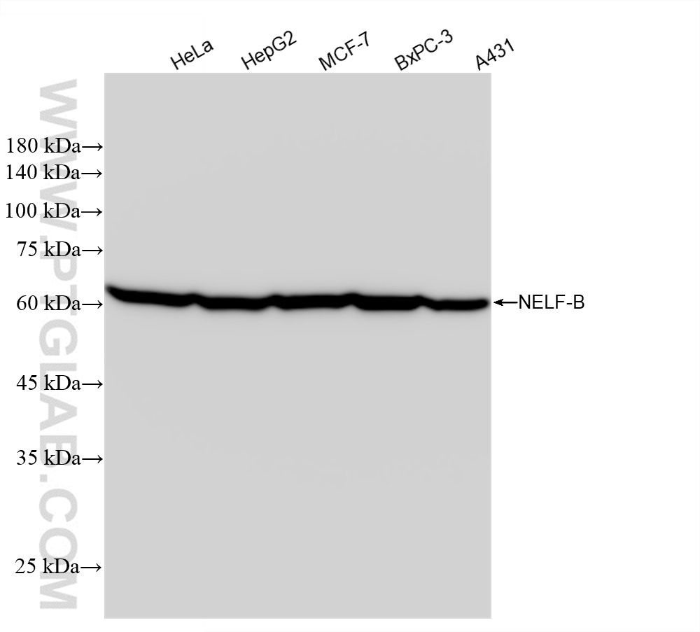 Western Blot (WB) analysis of various lysates using NELFB Recombinant antibody (84135-4-RR)