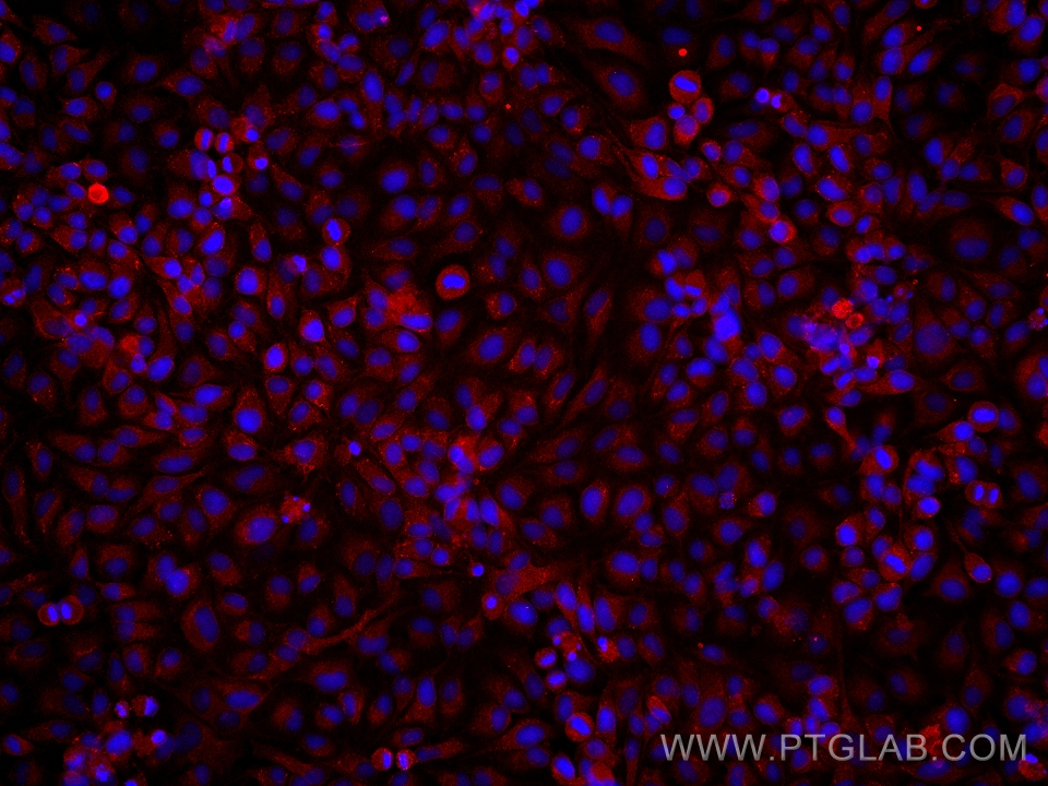 Immunofluorescence (IF) / fluorescent staining of HeLa cells using Neudesin/NENF Monoclonal antibody (60131-1-Ig)