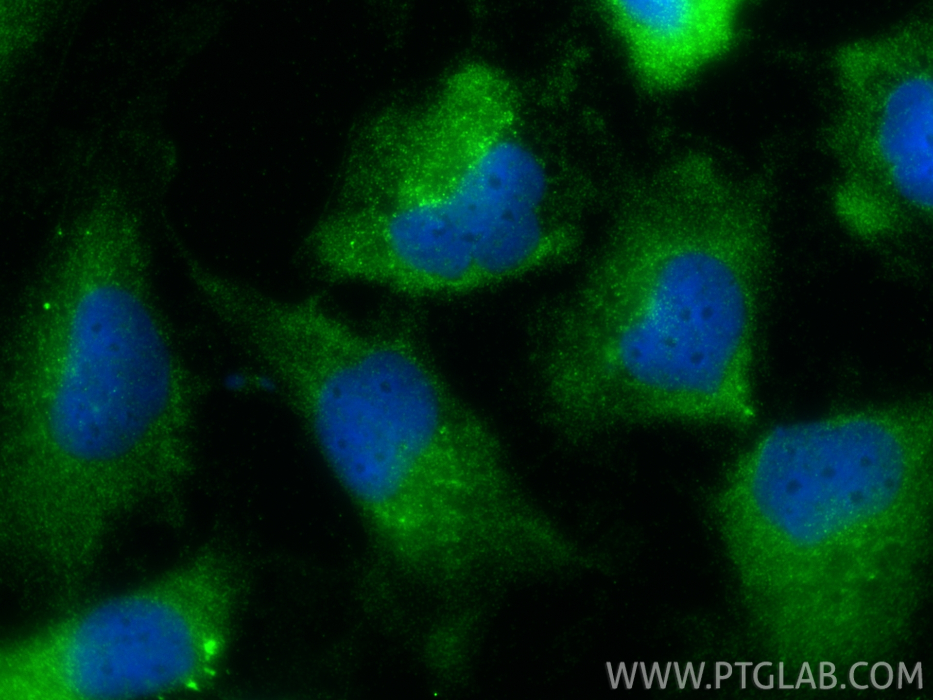 Immunofluorescence (IF) / fluorescent staining of U-251 cells using Nestin Polyclonal antibody (19483-1-AP)