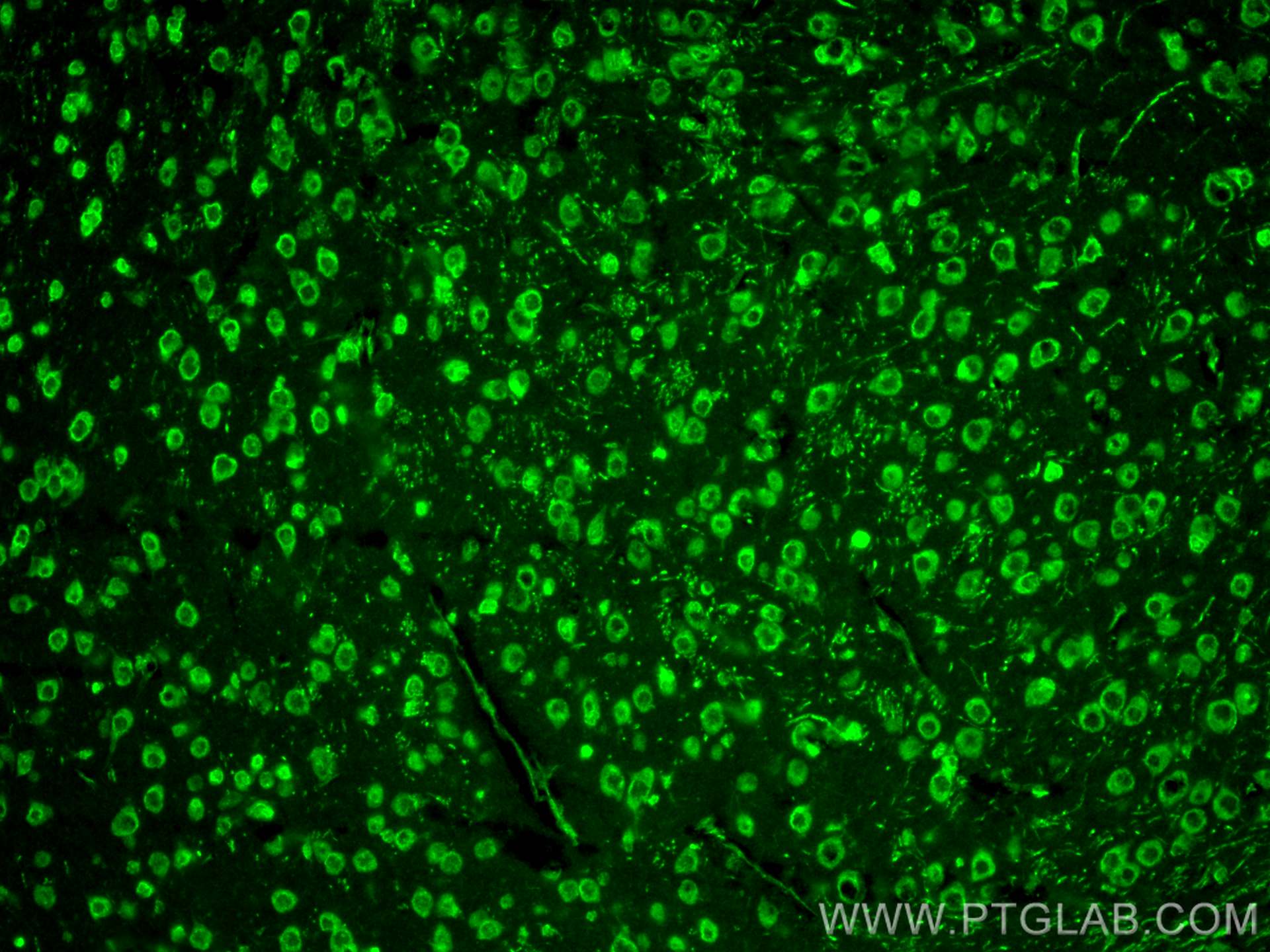 Immunofluorescence (IF) / fluorescent staining of mouse brain tissue using Nestin Polyclonal antibody (30760-1-AP)