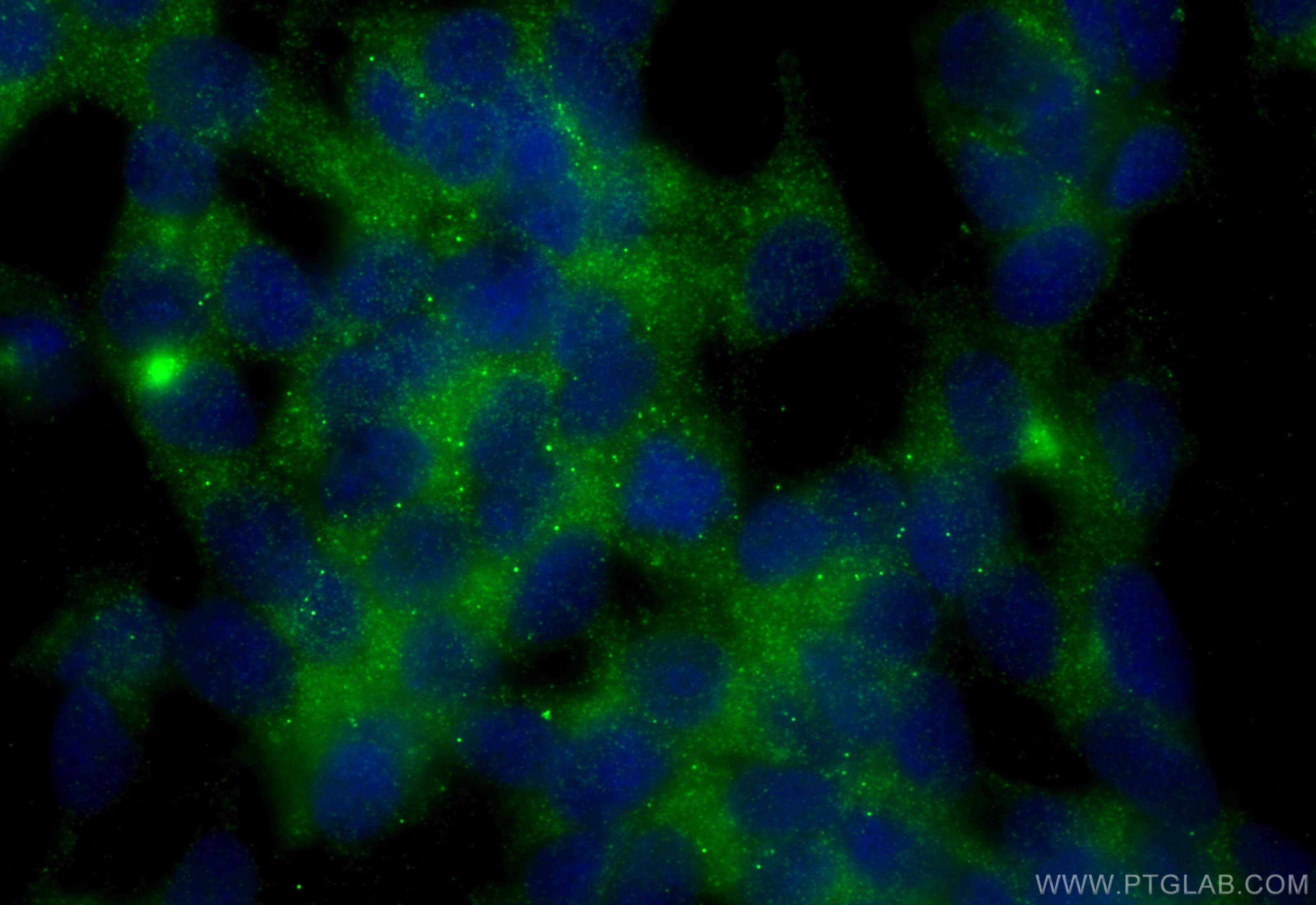 Immunofluorescence (IF) / fluorescent staining of SH-SY5Y cells using Nestin Polyclonal antibody (30760-1-AP)