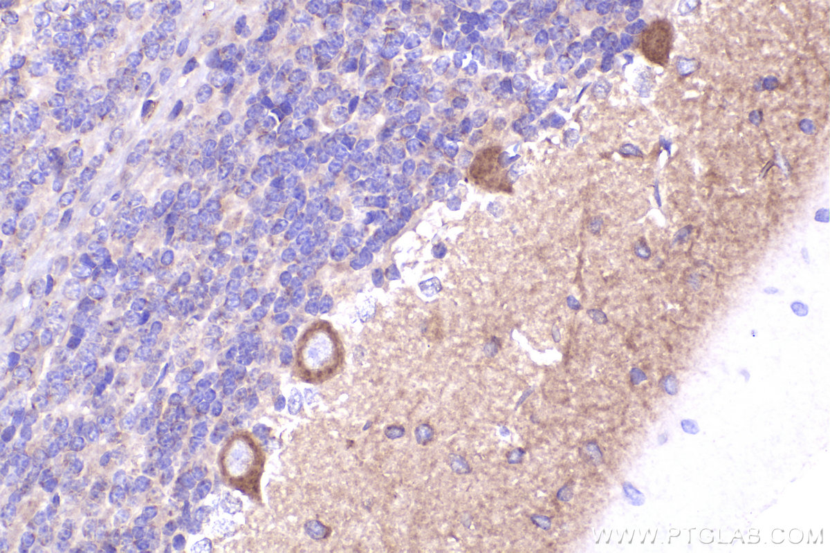 Immunohistochemistry (IHC) staining of rat cerebellum tissue using Nestin Polyclonal antibody (30760-1-AP)