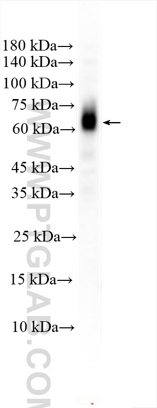 Western Blot (WB) analysis of rat testis tissue using NESG1 Polyclonal antibody (21077-1-AP)