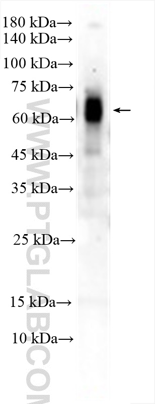 Western Blot (WB) analysis of mouse testis tissue using NESG1 Polyclonal antibody (21077-1-AP)