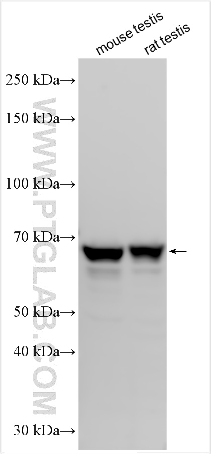 Western Blot (WB) analysis of various lysates using NESG1 Polyclonal antibody (21077-1-AP)