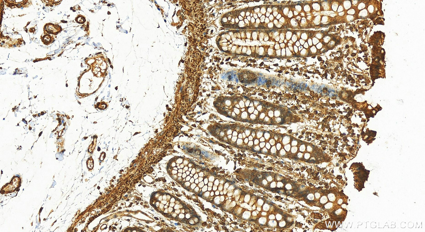 Immunohistochemistry (IHC) staining of human colon tissue using GNAS Polyclonal antibody (10150-2-AP)