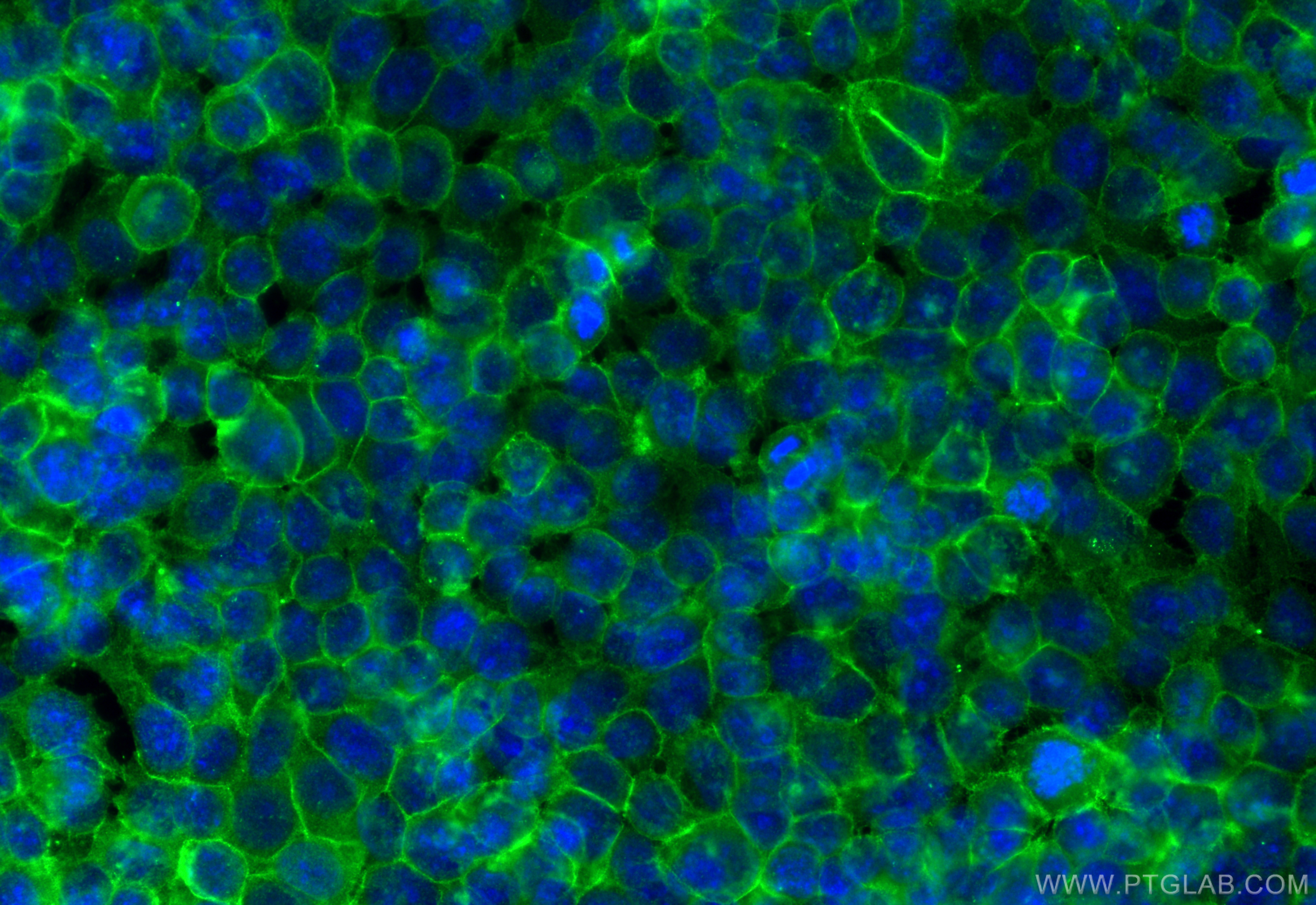 Immunofluorescence (IF) / fluorescent staining of MCF-7 cells using GNAS Polyclonal antibody (10150-2-AP)