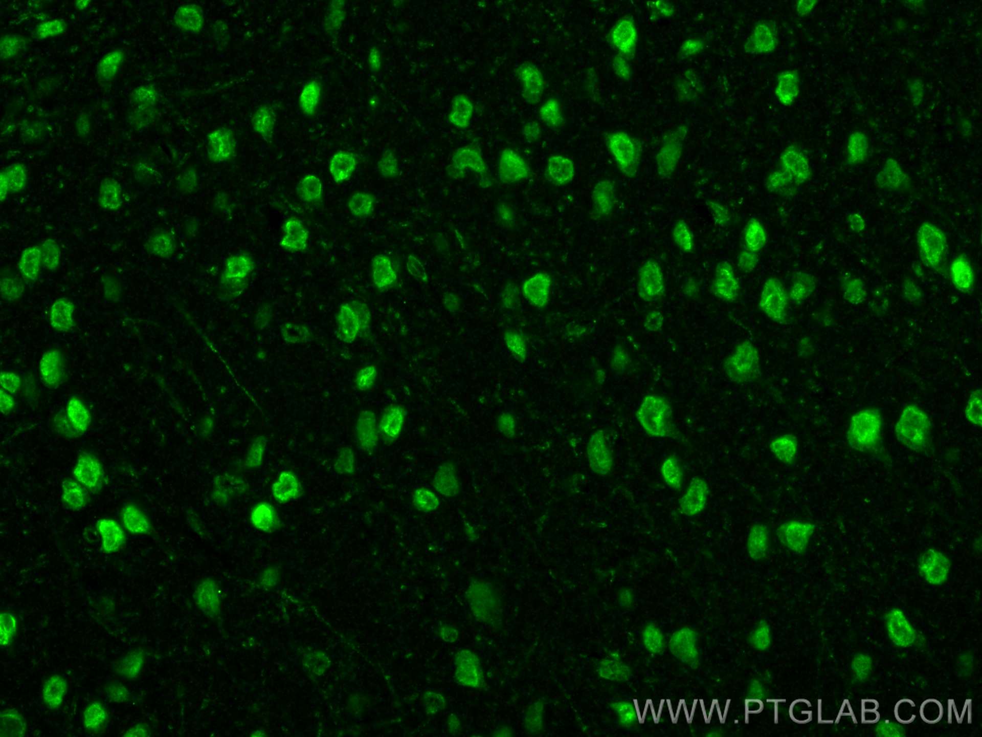 Immunofluorescence (IF) / fluorescent staining of mouse brain tissue using NET1 Polyclonal antibody (28180-1-AP)