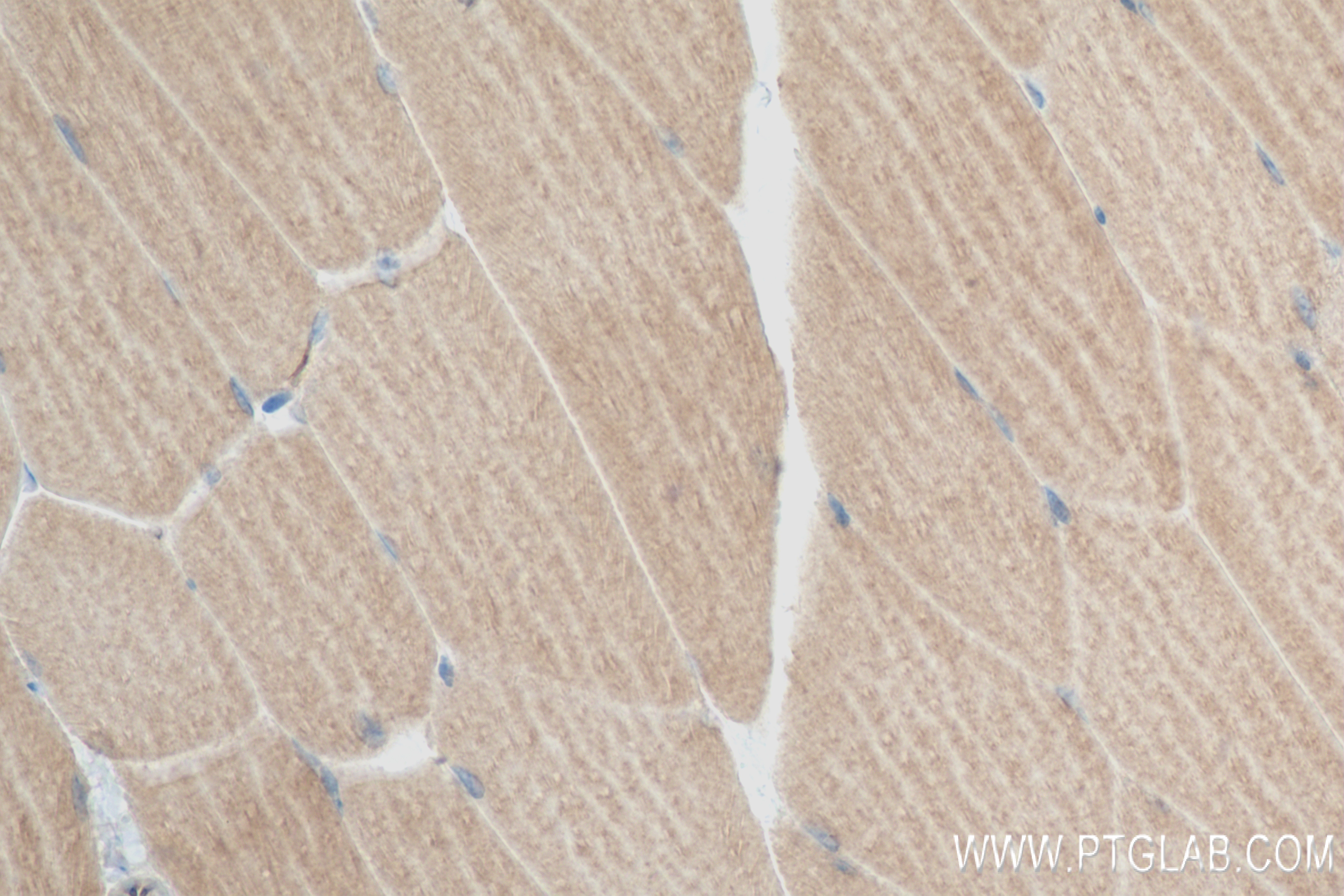 Immunohistochemistry (IHC) staining of mouse skeletal muscle tissue using NEU2 Recombinant antibody (83934-1-RR)