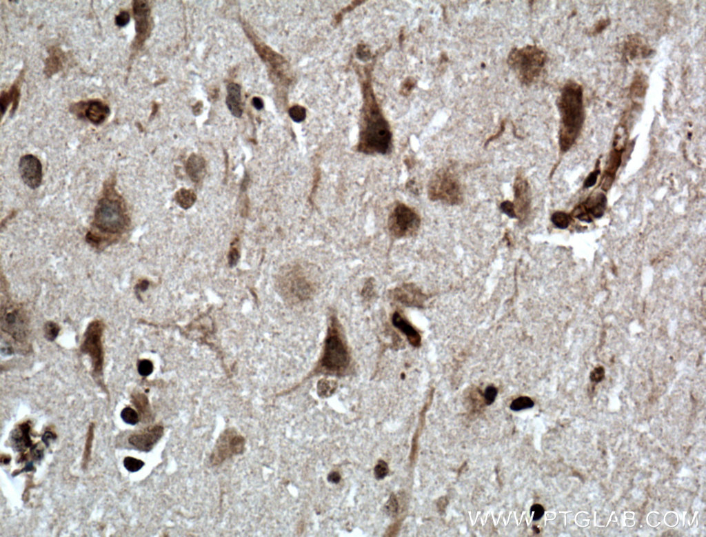 Immunohistochemistry (IHC) staining of human brain tissue using NEUROG1 Polyclonal antibody (12314-1-AP)