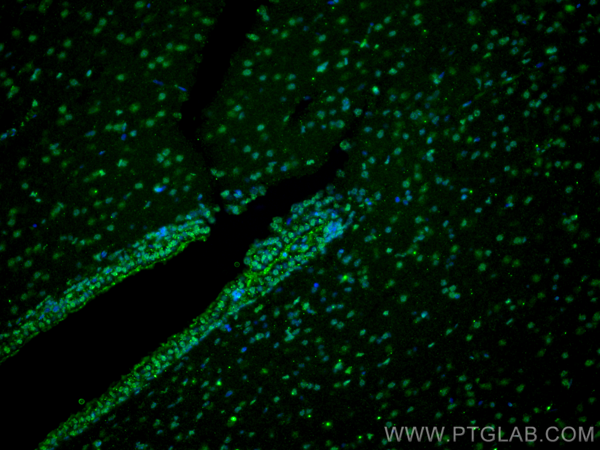 Immunofluorescence (IF) / fluorescent staining of rat brain tissue using NEUROG1 Monoclonal antibody (66642-1-Ig)