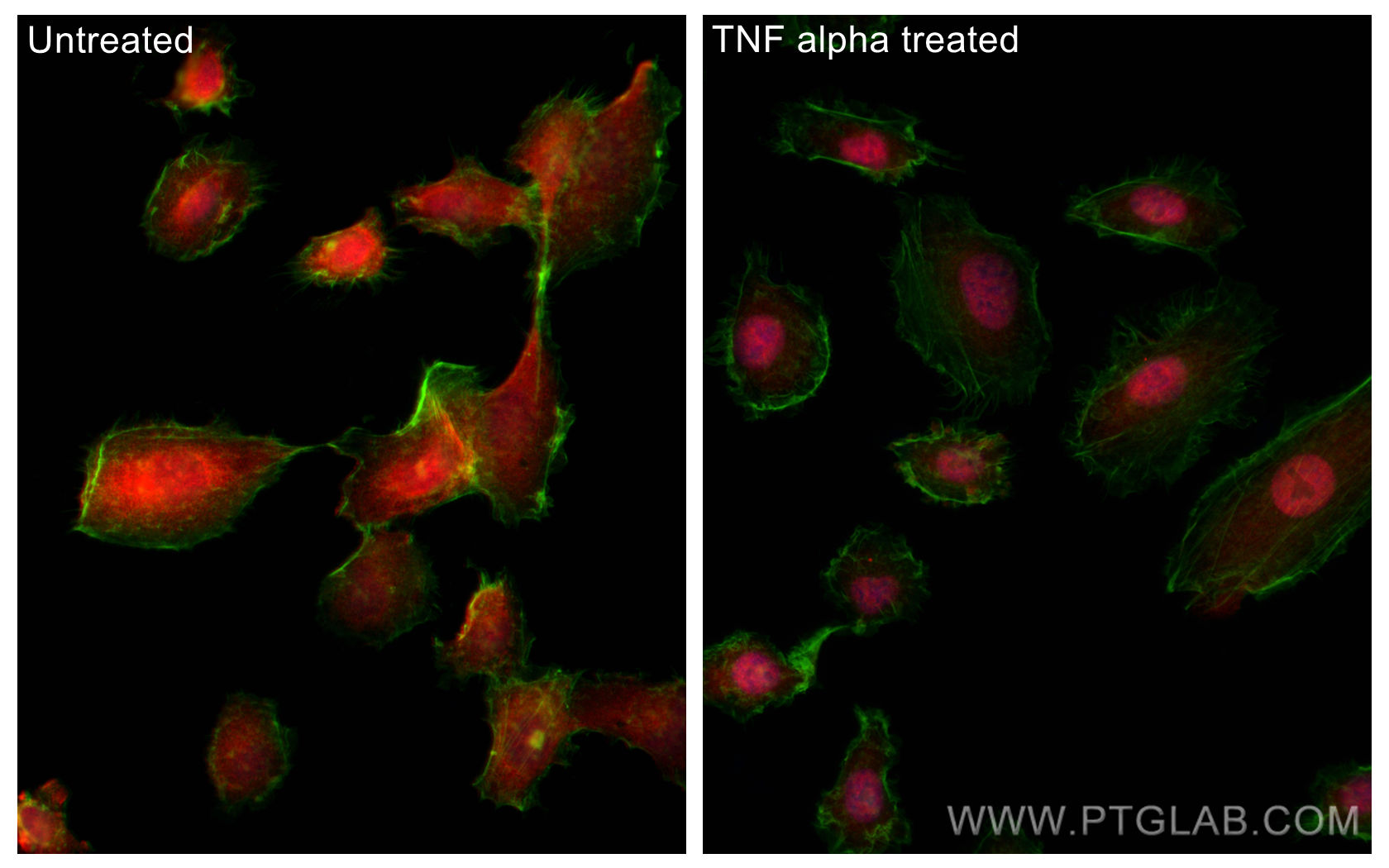 Immunofluorescence (IF) / fluorescent staining of HT-1080 cells using NF-κB p65 Recombinant antibody (80979-1-RR)