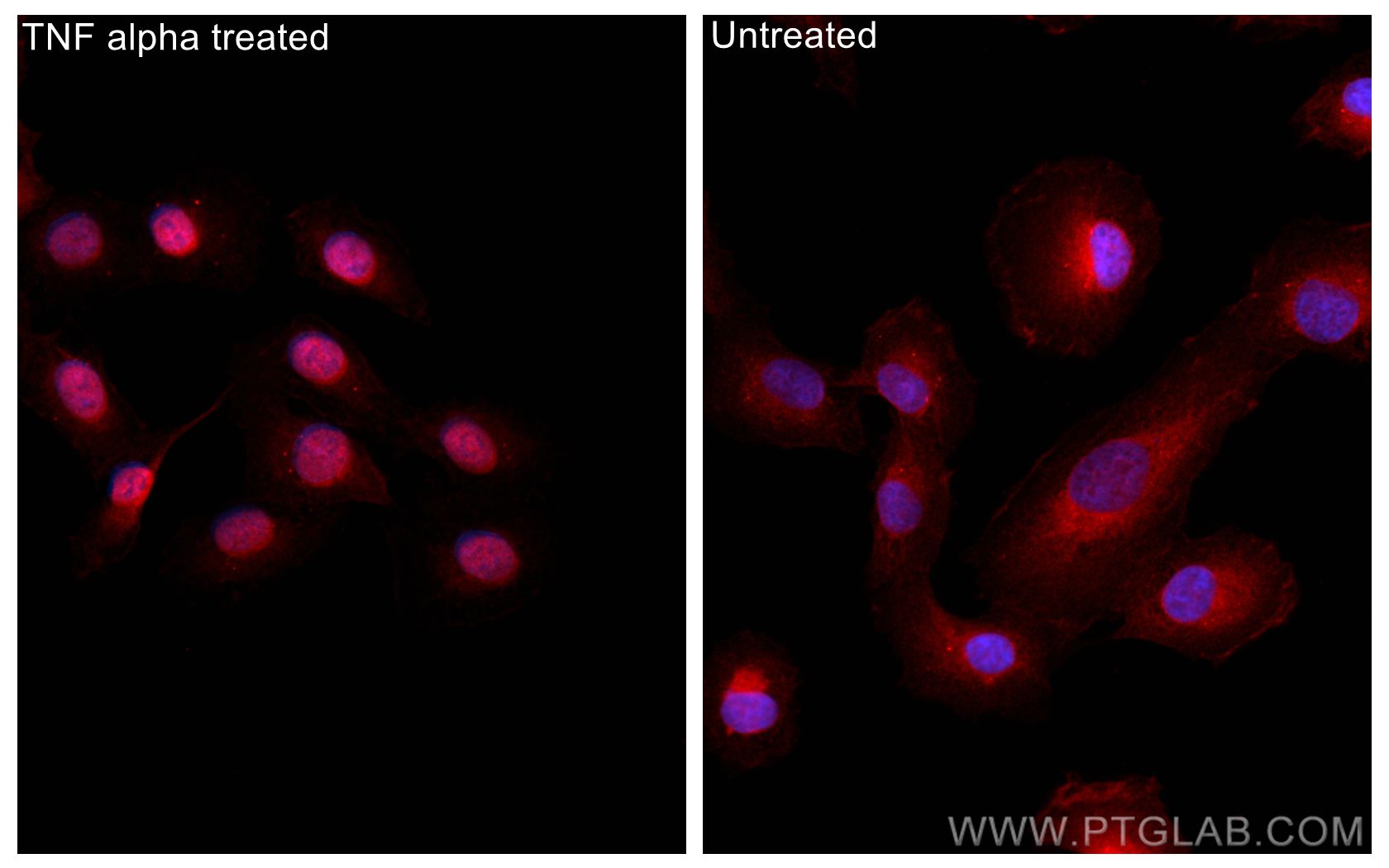 Immunofluorescence (IF) / fluorescent staining of HT-1080 cells using CoraLite®594-conjugated NF-κB p65 Polyclonal antib (CL594-10745)