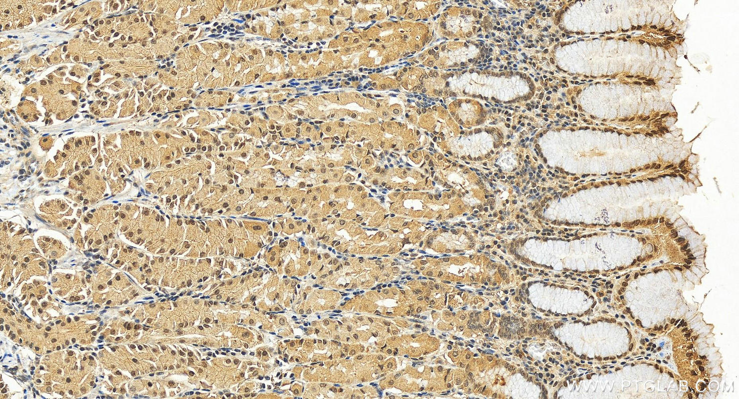 Immunohistochemistry (IHC) staining of human stomach tissue using NF2 Polyclonal antibody (10659-1-AP)