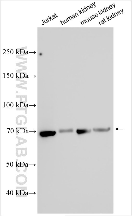 Western Blot (WB) analysis of various lysates using NF2 Polyclonal antibody (10659-1-AP)