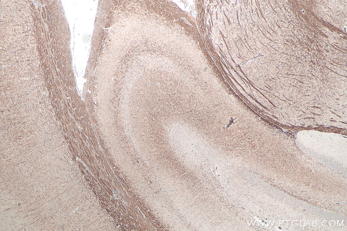 Immunohistochemistry (IHC) staining of rat brain tissue using NF-H/NF200 Monoclonal antibody (60331-1-Ig)