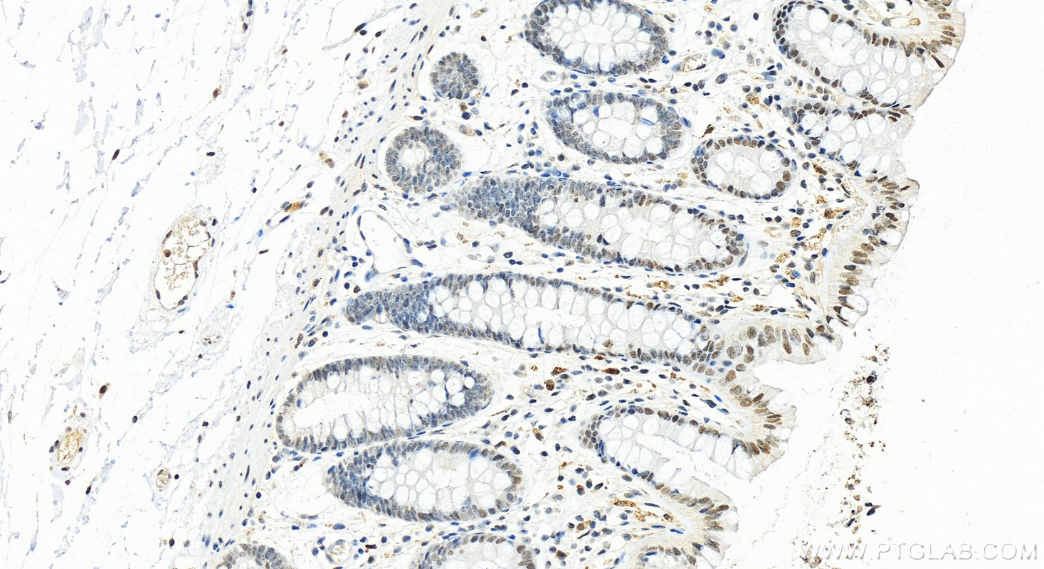 Immunohistochemistry (IHC) staining of human colon tissue using NF45 Polyclonal antibody (24572-1-AP)