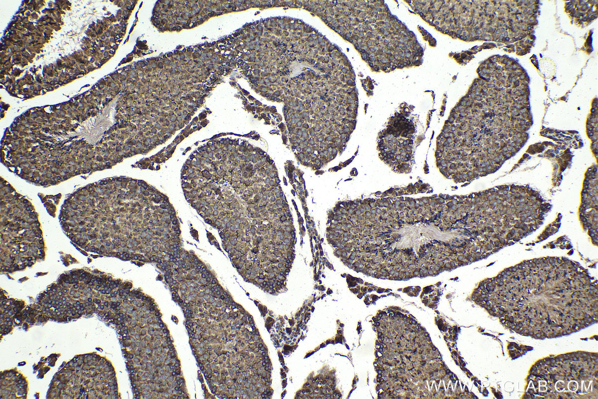 Immunohistochemistry (IHC) staining of mouse testis tissue using NFATC3 Polyclonal antibody (18222-1-AP)