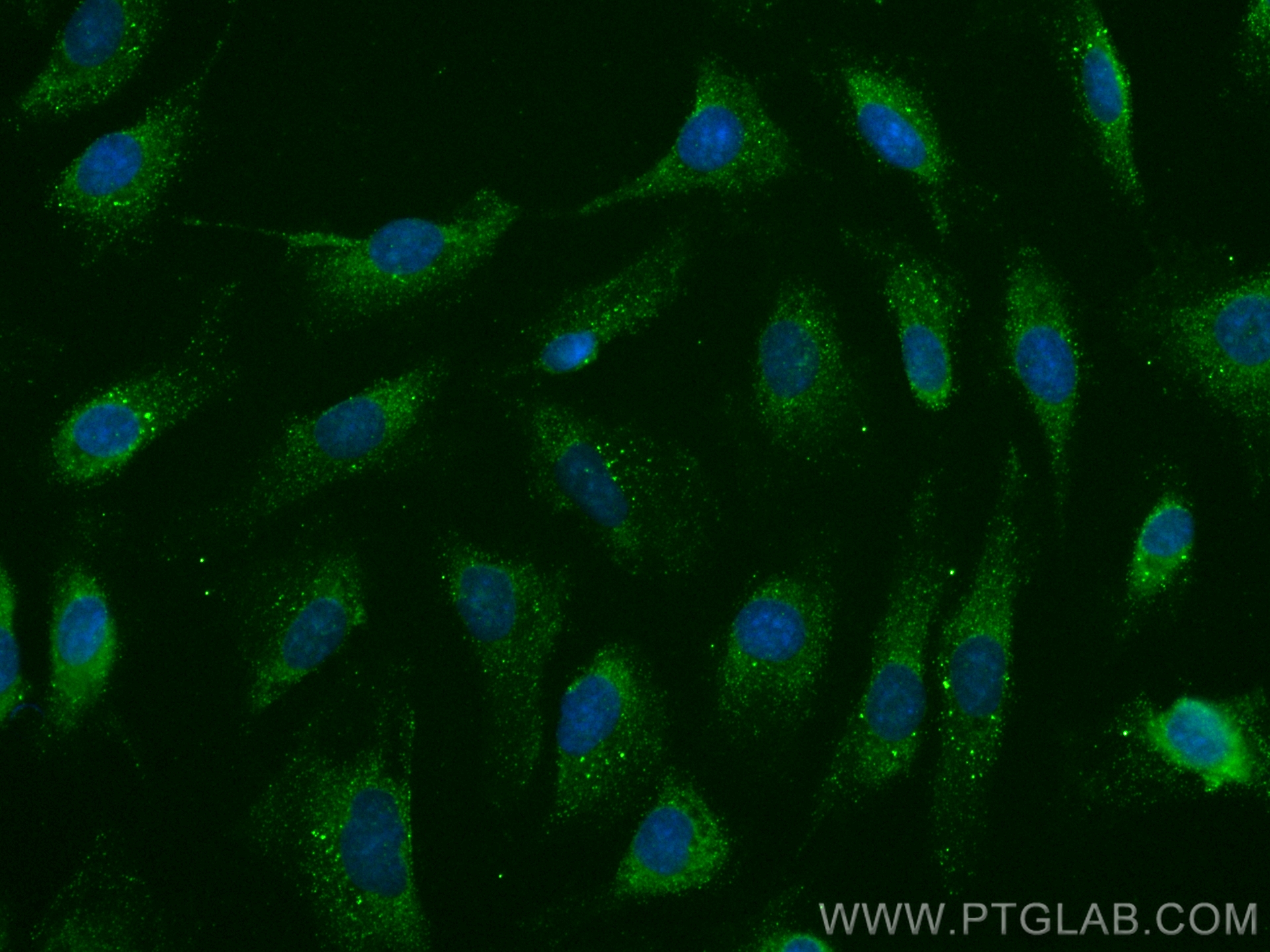 Immunofluorescence (IF) / fluorescent staining of SKOV-3 cells using NFATC3 Monoclonal antibody (66924-1-Ig)