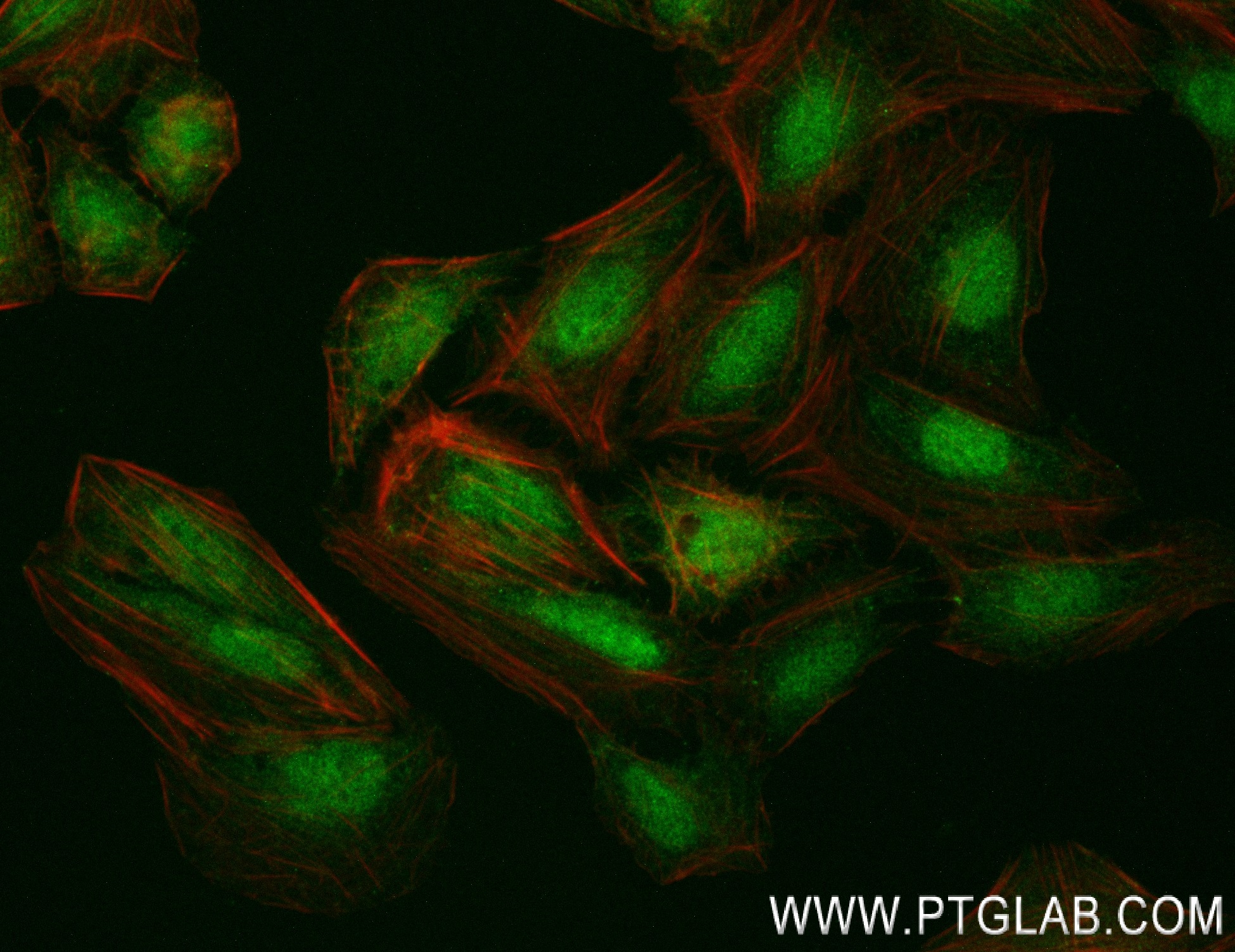 Immunofluorescence (IF) / fluorescent staining of HepG2 cells using NFE2L1 Recombinant antibody (83987-2-RR)